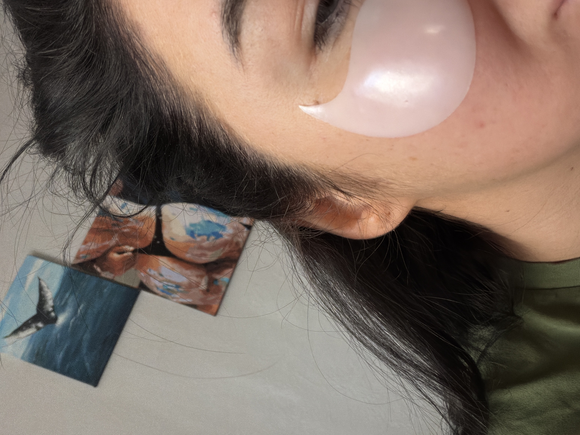 A close-up, tilted view of a person's face wearing a pale pink eye patch underneath the left eye. The person has dark hair, visible eyebrows, and ear. Next to their face are two small photographs: one of sea life and the other of something abstract. The person is wearing an olive green shirt. The surface they are on appears to be gray. The image doesn't provide information that places the subject in Moscow, Russia.