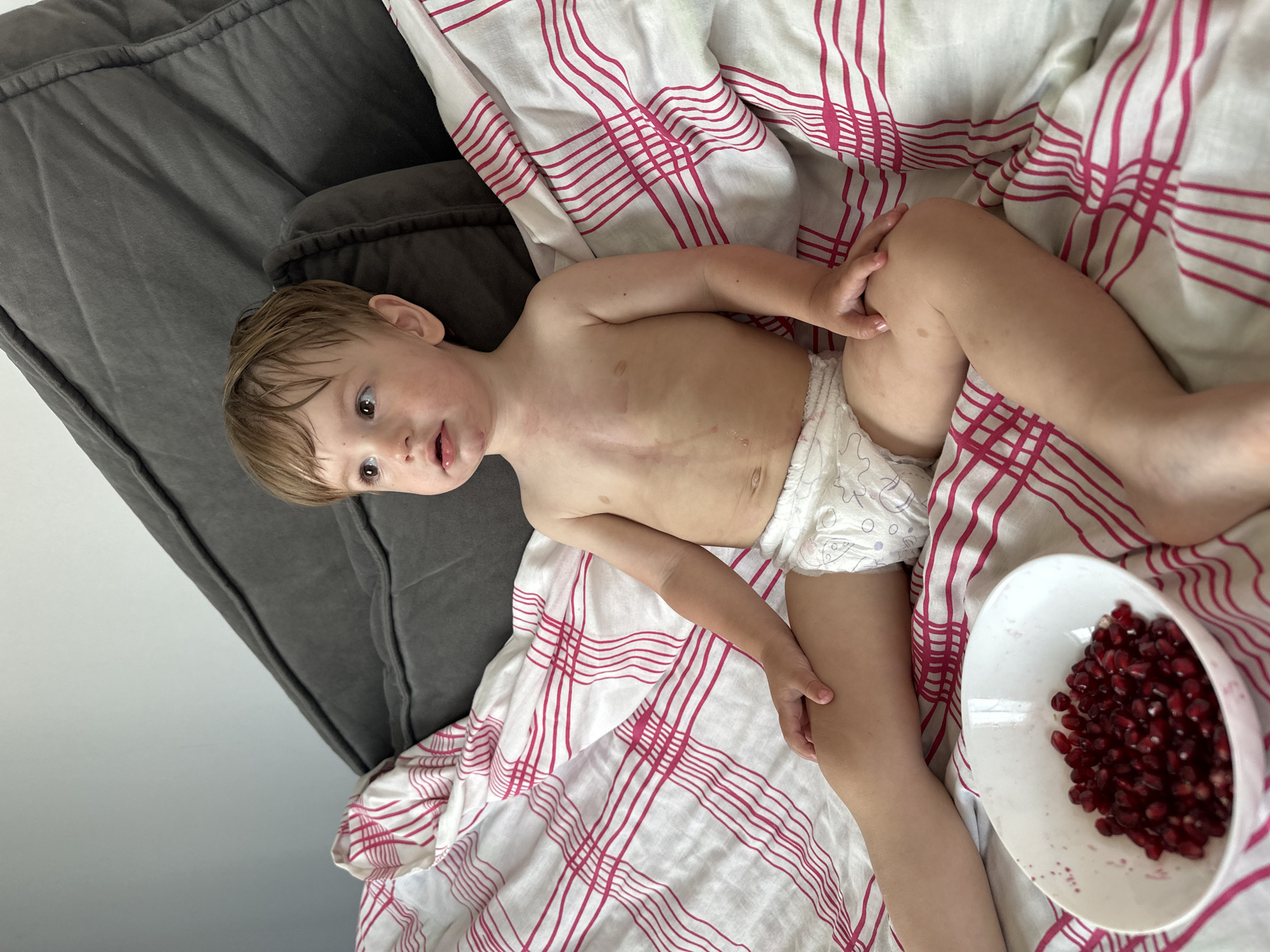 A young child wearing a diaper sits on a bed covered with white and pink striped bedding. The child is looking to the left of the frame with an open mouth. A white bowl filled with pomegranate seeds sits on the bed in front of the child. The child's chest and legs have some reddish marks and lighter brown spots. In the background, a large grey pillow or cushion is visible against a light grey wall. The scene appears to be indoors, likely a bedroom.