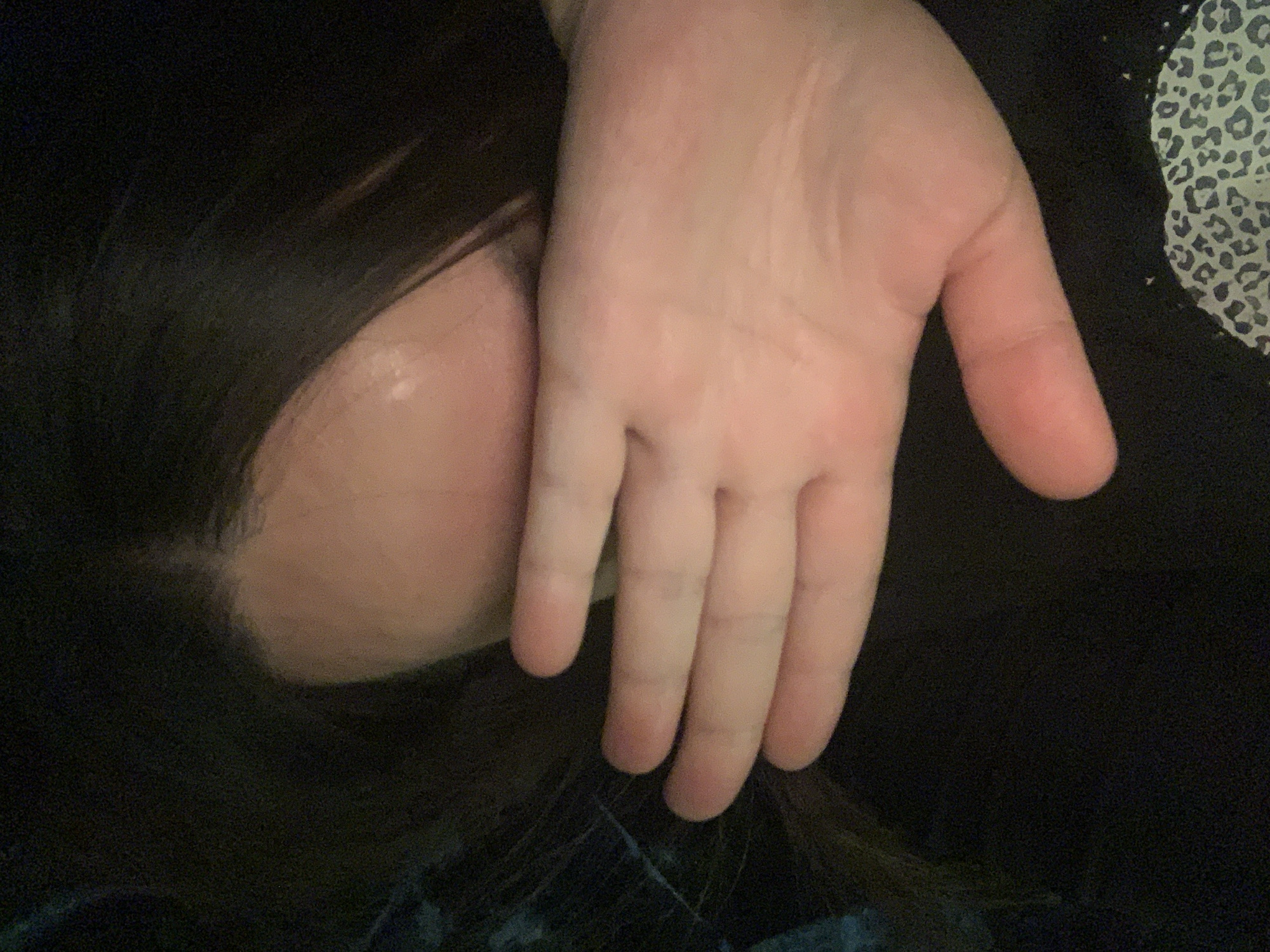 A close-up, dimly lit shot shows the forehead and eye area of a person, obscured by their left hand. The skin appears pale, with some shine on the forehead. Long, dark hair frames the face. The hand, with fingers spread, covers the eye region. The background is mostly dark, with hints of a patterned fabric visible at the bottom right. The scene is indoors, with no discernible urban context.