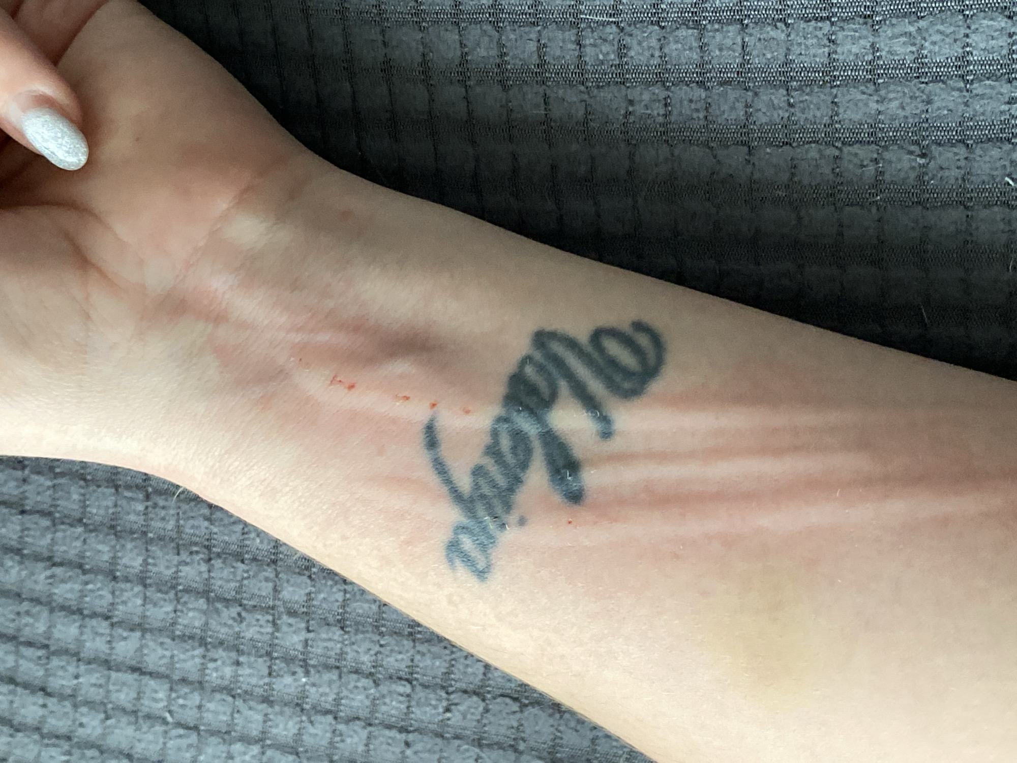 A forearm rests against a gray, textured fabric surface. The arm has a cursive tattoo reading "Always". There is noticeable redness and irritation along the forearm, radiating from the tattoo. A fingernail with glittered nail polish is visible at the top left of the image. No information about the location in the city of Markovskii, Russia is present.