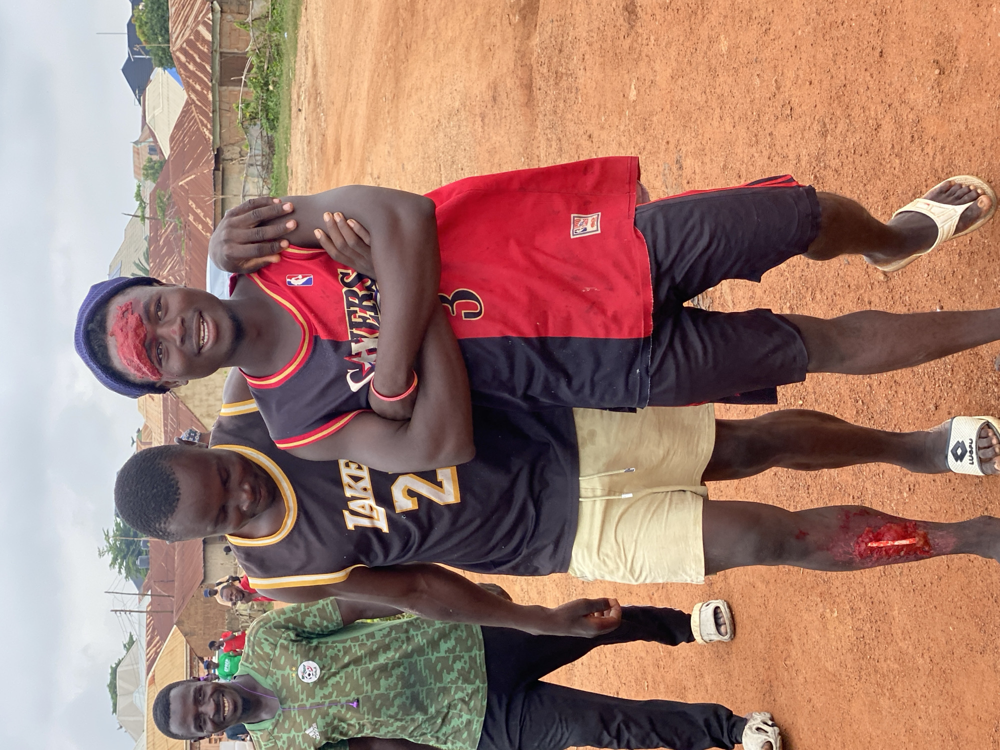 Two young men, likely in their late teens or early twenties, are posing for a photograph outdoors in an unpaved area. The man on the right has a significant wound on his forehead, with what appears to be blood and tissue visible. He is wearing a blue beanie, a sleeveless, two-toned jersey (red and black) with the number "3" on it, and black shorts. The man on the left is wearing a black sleeveless jersey with "LAKERS 2" printed on it, and light-colored shorts. He has a visible wound on his lower left leg, which appears to be a deep laceration with some exposed bone or foreign object. Both men have their arms around each other. In the background, other individuals are present, along with buildings with corrugated iron roofs. The ground is a reddish-brown, indicative of dirt or laterite soil. The sky is overcast. This scene is consistent with the general environment of Kawo, a district in Kaduna, Nigeria, which is characterized by such unpaved urban spaces and residential areas.