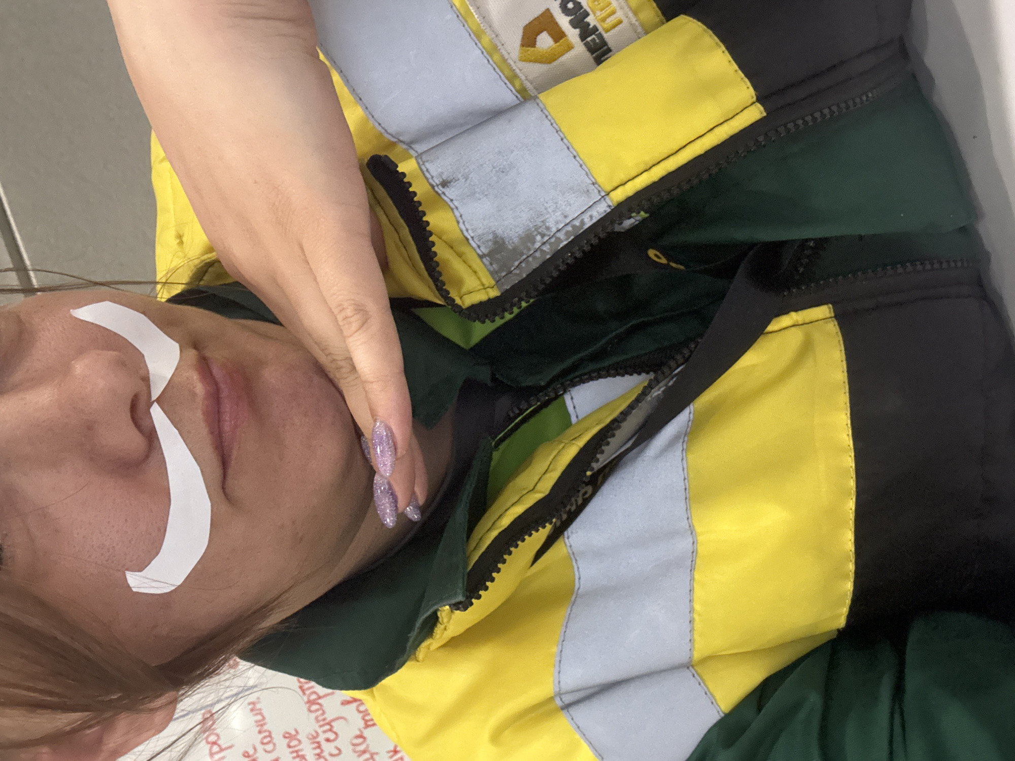 A disoriented woman with a band-aid on her face is shown in a close-up, tilted view. She is wearing a multi-colored jacket, featuring yellow, gray, green, and black sections. Her left hand is visible, and she appears to be resting her head on her hand or near it. The location is unknown.