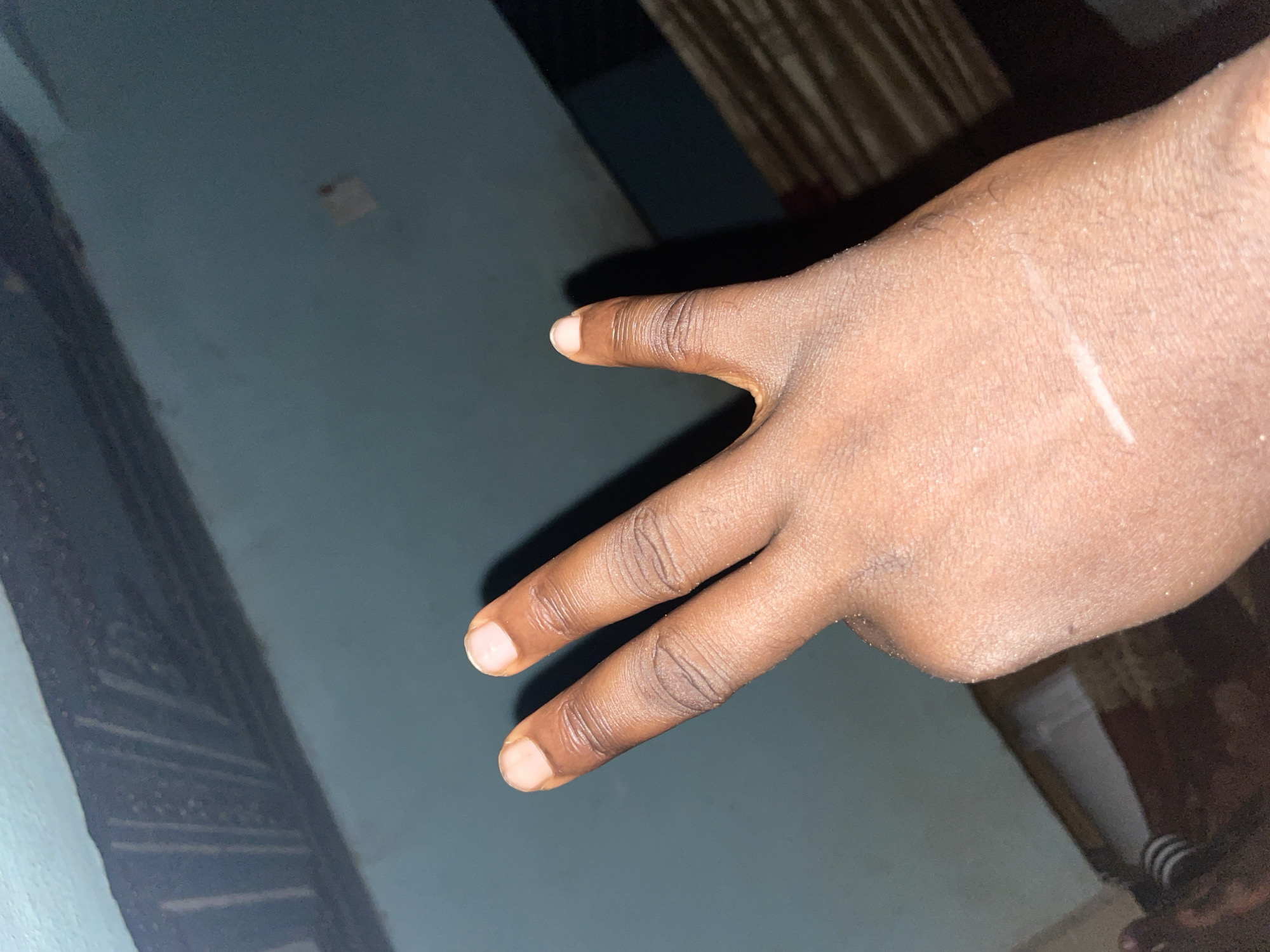 A hand, with three fingers extended and a thumb bent downwards, is shown in the foreground. The skin tone is dark brown, and there are visible finger lines and a faint scar on the back of the hand. The background consists of a teal-colored wall with a dark horizontal beam above it. The beam has faint vertical lines etched into it. The lower portion of the background shows a dark, indistinct area that appears to be a room with striped patterns and some vertical blinds. There is no specific indicator of the location being Jalingo, Nigeria.