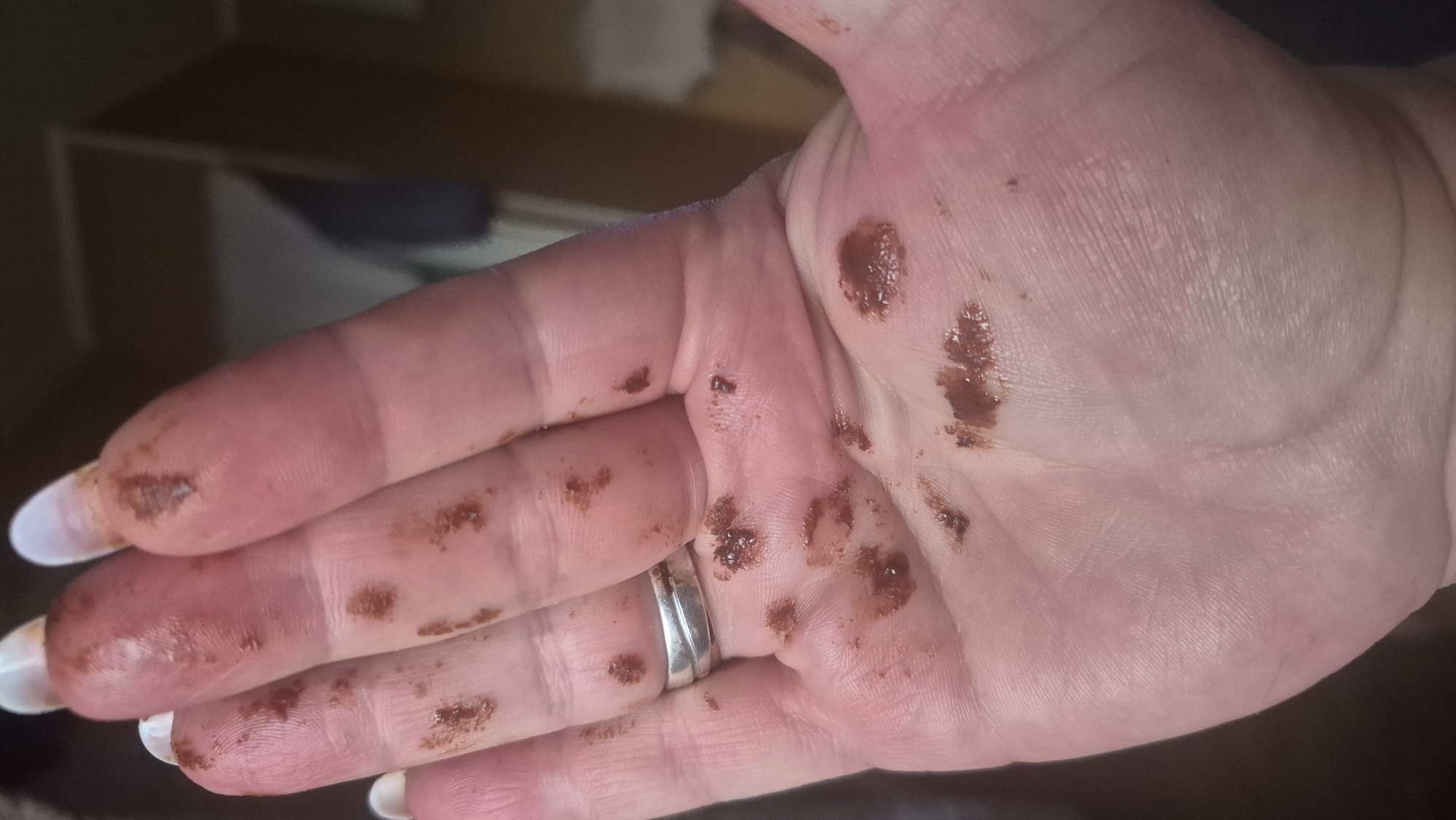 The image displays a person's left hand, palm up, with fingers curled slightly. The hand and fingers are smeared with a dark, granular substance, likely chocolate. There are several distinct smudges and specks of the substance across the palm and fingers. A silver ring with two bands is visible on the ring finger. The background is out of focus and appears to be an indoor setting, possibly a kitchen or living area. No geographical location in Krauja, Latvia, is depicted or implied.