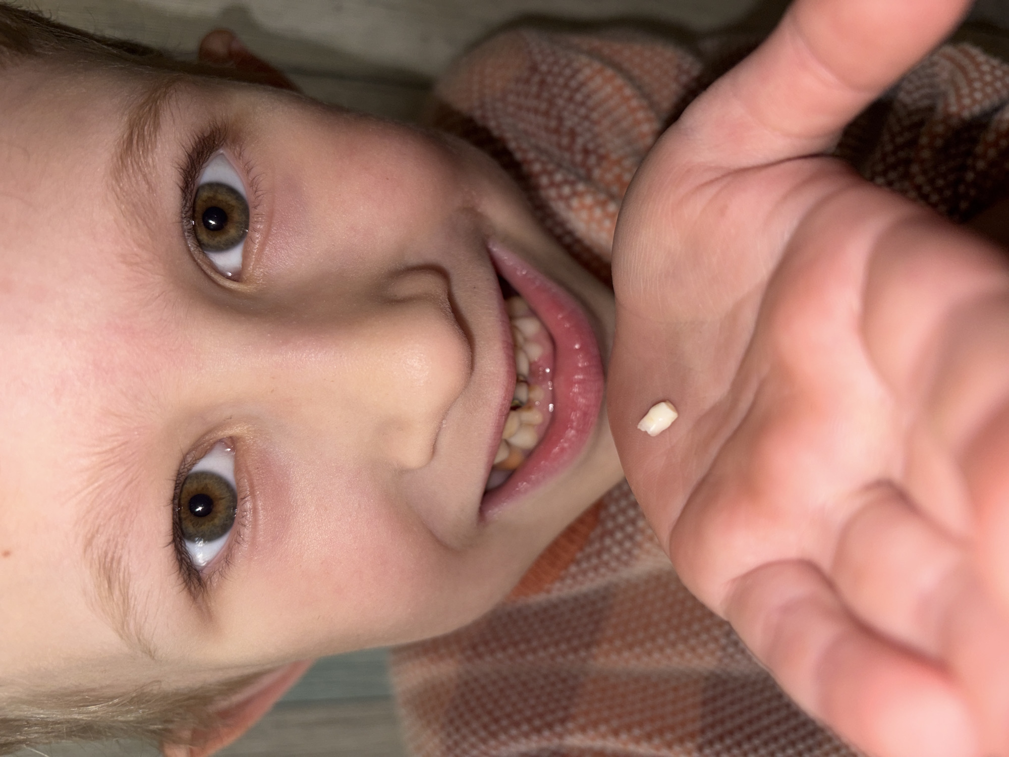 A close-up, portrait-style photograph captures a young child, likely in Chaikovsky, Russia, looking directly at the camera with a wide, joyful smile. The child, with fair skin and light brown eyes, is lying down, and the image has a slightly tilted perspective. The central focus is on the child's face and their outstretched right hand, which holds a small, white milk tooth in its palm.
The child's wide-open mouth reveals several teeth, some of which appear discolored or show signs of dental work, and there is a noticeable gap, indicating where the displayed tooth might have come from. Their eyes are wide and bright, conveying excitement and pride. The child is wearing a patterned garment, possibly a sweater or blanket, with a repeating light brown or orange and white speckled or striped design. The background is softly blurred, suggesting an indoor setting. The photograph captures a moment of happiness and celebration surrounding the childhood milestone of losing a baby tooth. No text is visible in the image.