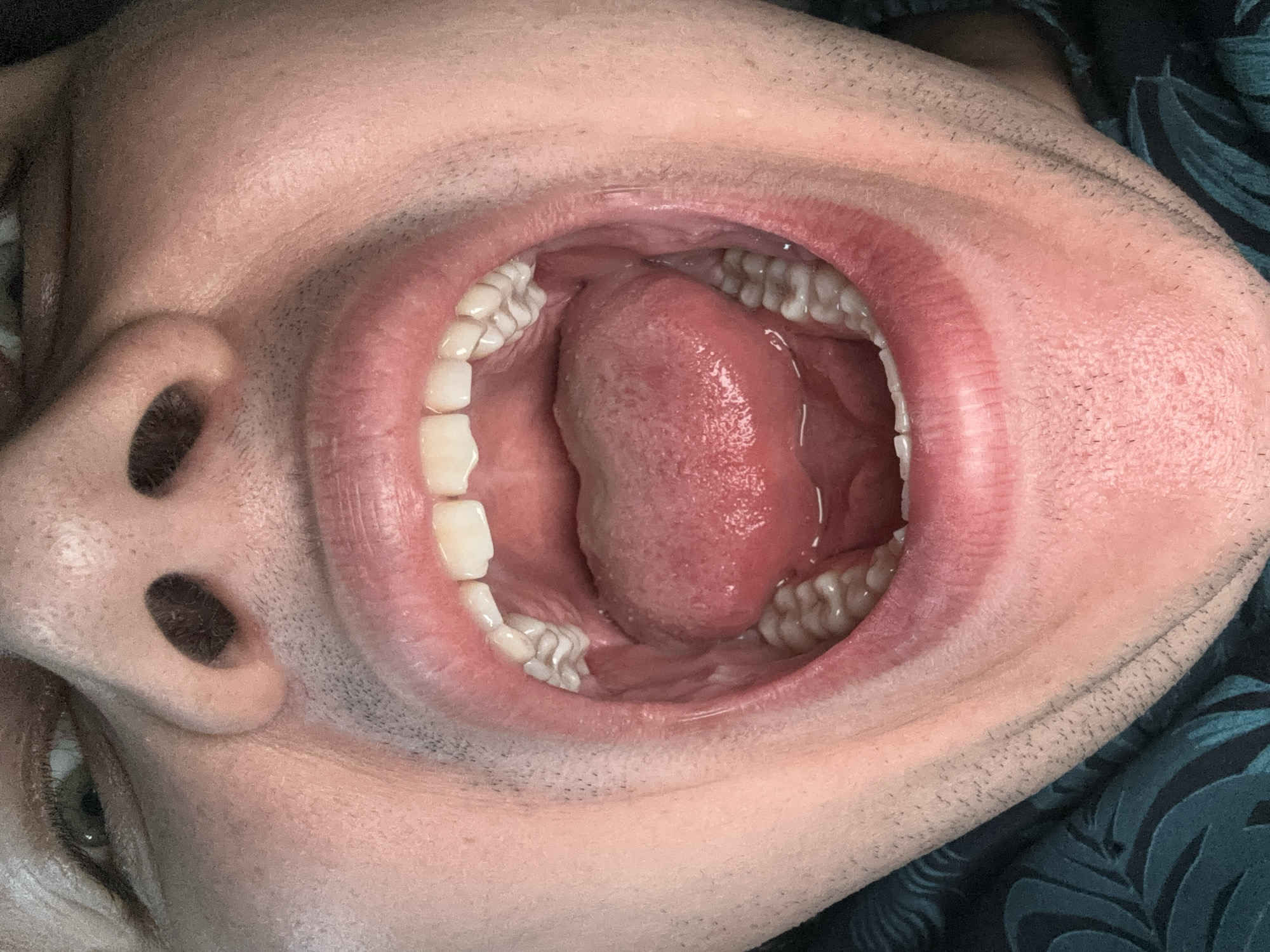 This is a close-up, upside-down photograph of a person's open mouth, nose, and eye, taken indoors. The subject is likely an adult male, given the visible facial hair around the mouth and chin. The camera angle is from below, looking up into the mouth.
Inside the mouth, the tongue is visible, resting in the floor of the mouth. The teeth are white and appear to be in good condition. The gums are pink. The inside of the cheeks and the palate are also visible, with a slightly red and moist appearance.
The nose is prominent in the upper left portion of the image, with nostrils visible. A portion of the subject's left eye is also visible, with green irises and dark eyelashes. The skin of the face appears to have some texture and stubble. The subject is wearing a dark green shirt with a leaf pattern.
The lighting suggests an indoor setting, possibly with artificial light. There is no indication of time of day, weather, or a specific geographical location. The overall mood conveyed by the image is neutral, focusing on the anatomical details of the face and mouth. There is no visible text in the image.