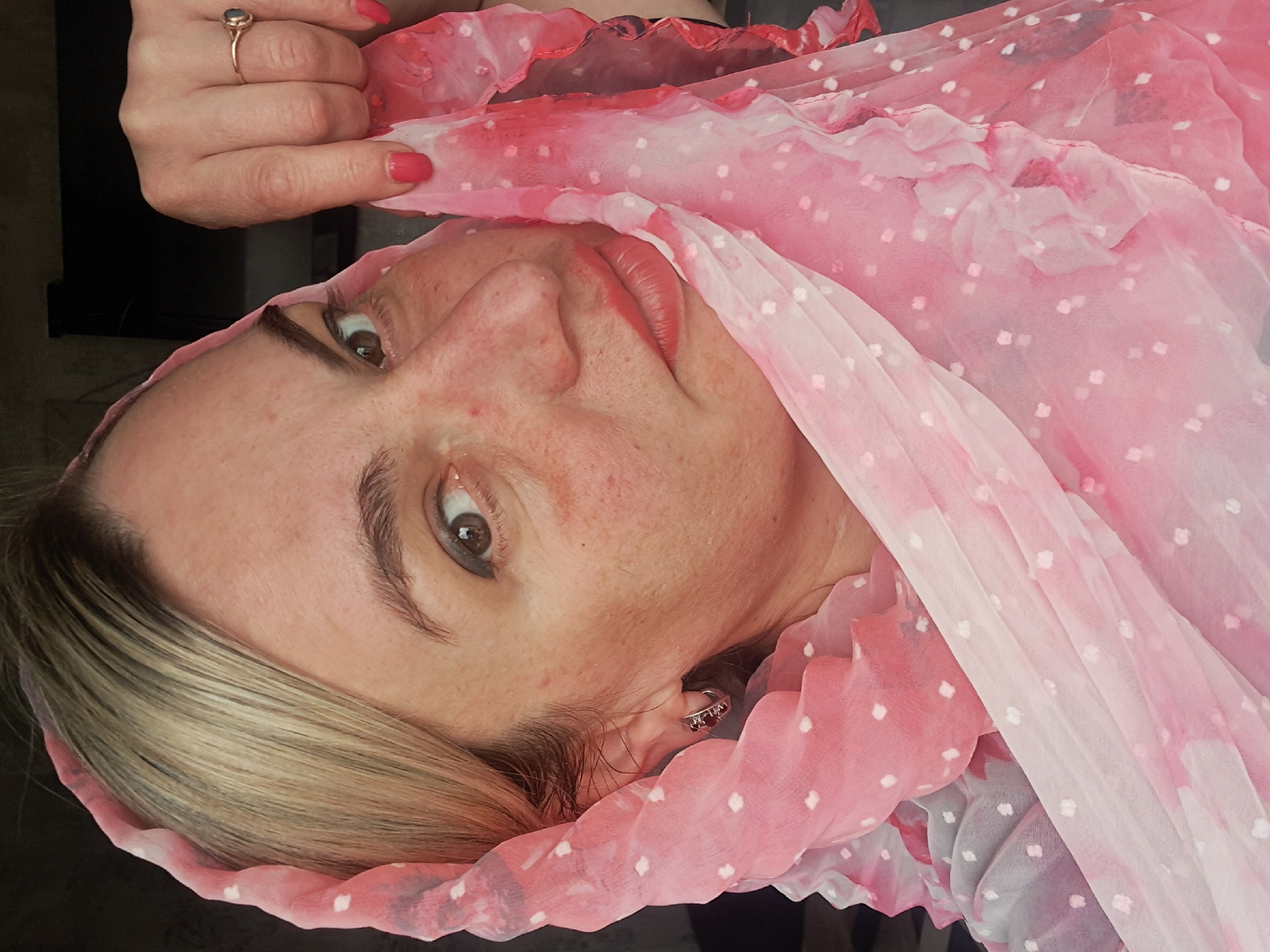 A woman is pictured from the chest up, tilted to the left. She has blond hair and fair skin, with visible redness and imperfections on her face. Her eyes are brown, and she wears light makeup on her eyelids and lips. A pink and white polka-dotted scarf partially covers her head and shoulders. A hand with a ring on the ring finger is visible in the top left corner, holding the scarf. The location is not discernible from the image.