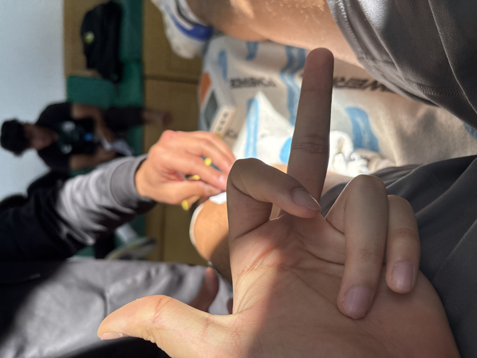 The image shows a close-up of a hand giving the middle finger. A second person is partially visible, seemingly attending to another individual's leg, possibly wrapping or bandaging it. In the background, a third person is sitting down, near a backpack. The overall setting appears to be an indoor space, perhaps a locker room or training area.