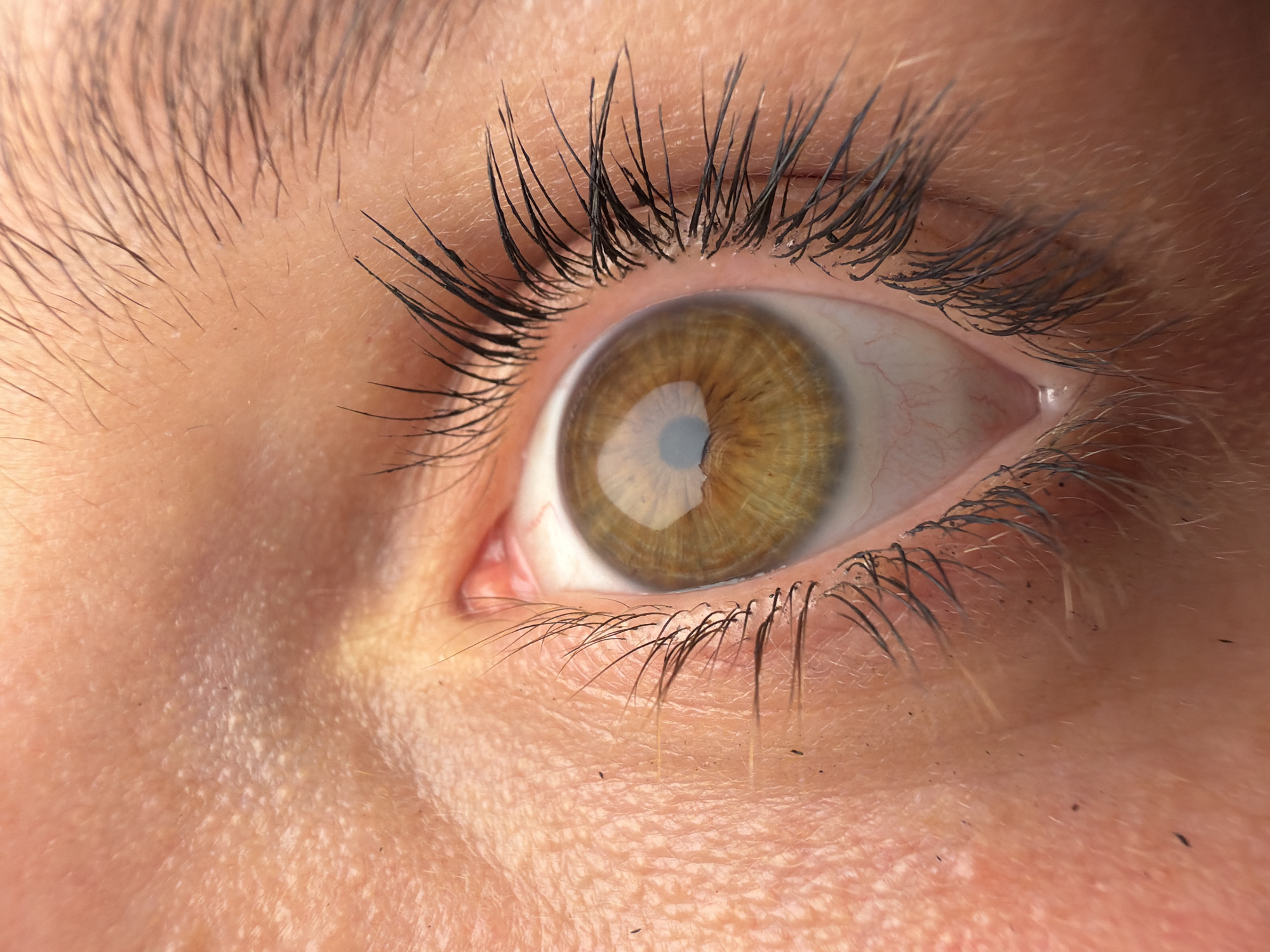 A close-up photograph depicts a human eye, exhibiting a light brown iris and black eyelashes. The surrounding skin is light-toned and shows fine wrinkles and hair follicles. There is no information in the image to identify the location as North Kuta, Indonesia.