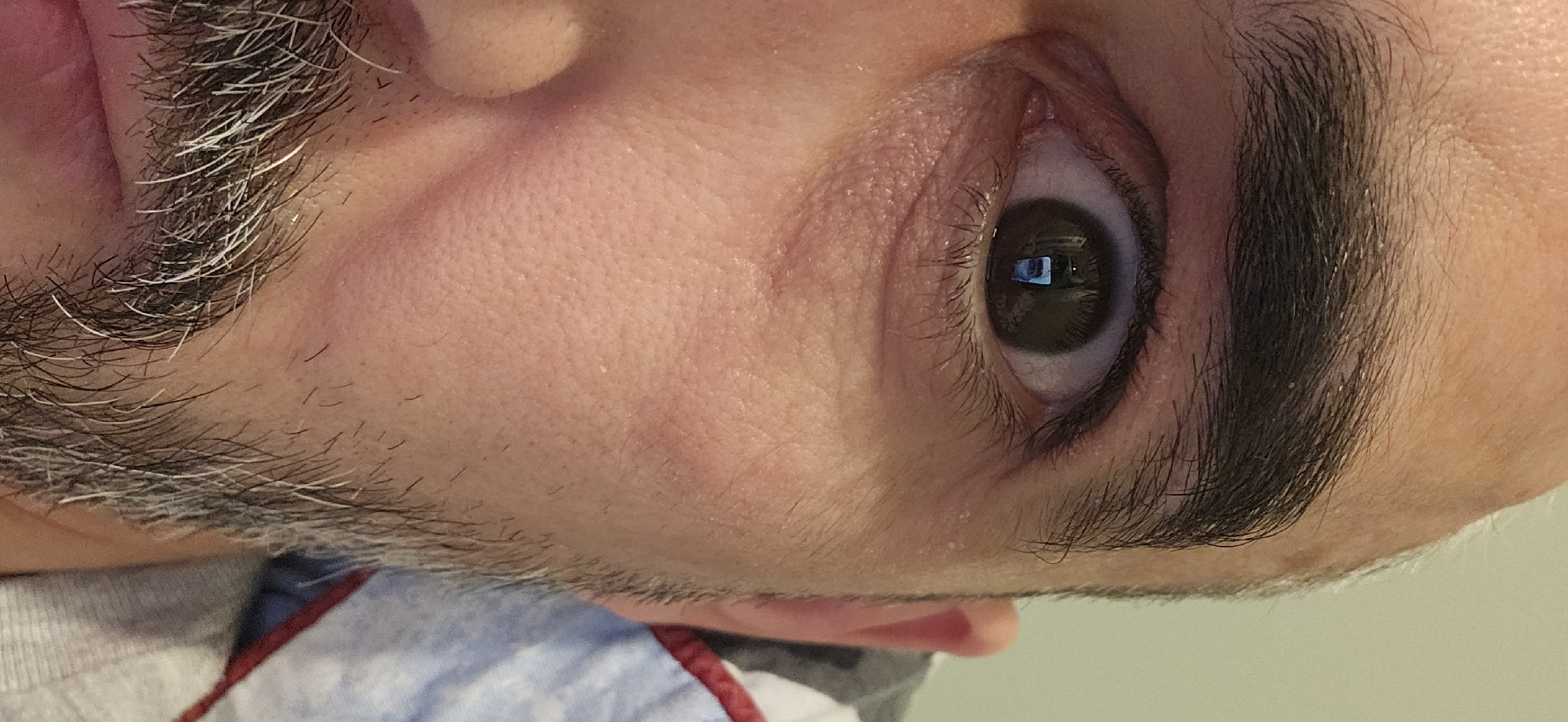 The image is a close-up, slightly rotated portrait focusing on a person's right eye and surrounding facial features. The subject, likely male, has dark brown eyes, with a distinct rectangular reflection visible within the pupil, suggesting an indoor setting with a light source such as a window or screen. Dark, full eyelashes frame the eye, and a thick, dark eyebrow sits above it. The skin around the eye exhibits visible texture, including pores and subtle fine lines. Below the eye, stubble or a short beard is visible, characterized by a mix of dark hairs and numerous prominent grey hairs, indicating age or a natural grey pattern. The overall tone is a detailed, candid portrayal of the upper facial area. No specific activity is depicted other than the subject gazing directly at the camera. The image provides no specific visual cues to its location, but the context indicates Norwich, United Kingdom. There is no visible text.