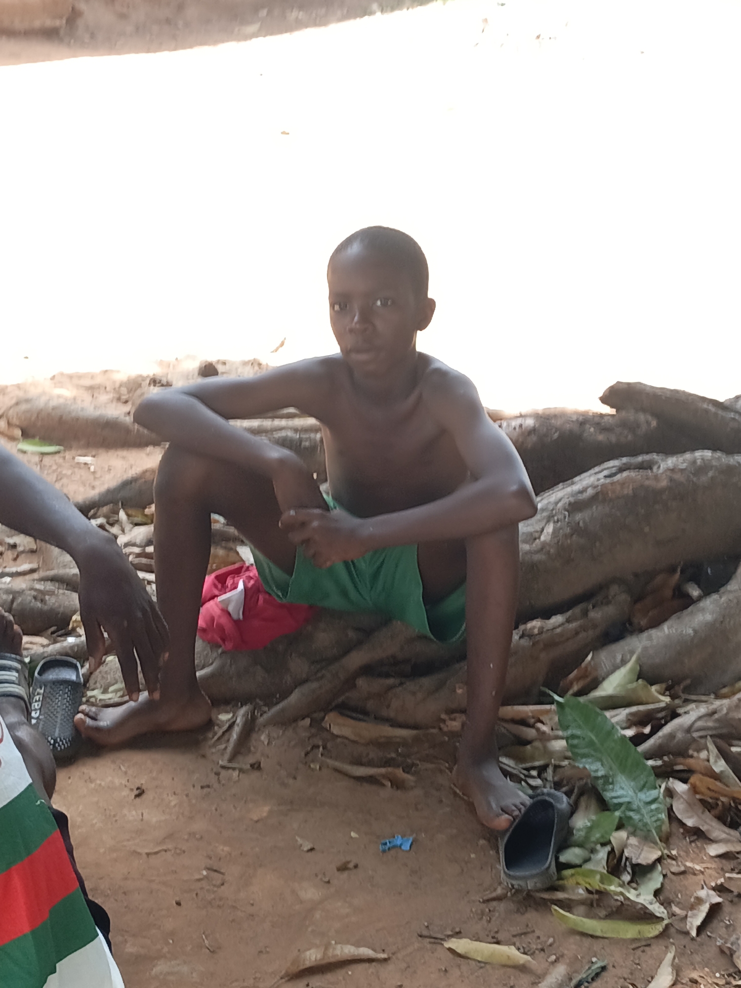 A young, shirtless African boy is seated on the exposed roots of a tree. He is wearing green shorts. He sits with his arms resting on his knees. The setting is a dirt clearing with leaves and debris scattered about. The edge of a person is visible to the left, wearing a striped shirt and shoes. A shoe is also visible on the ground near the boy. This is likely Akwanga, Nigeria based on context.