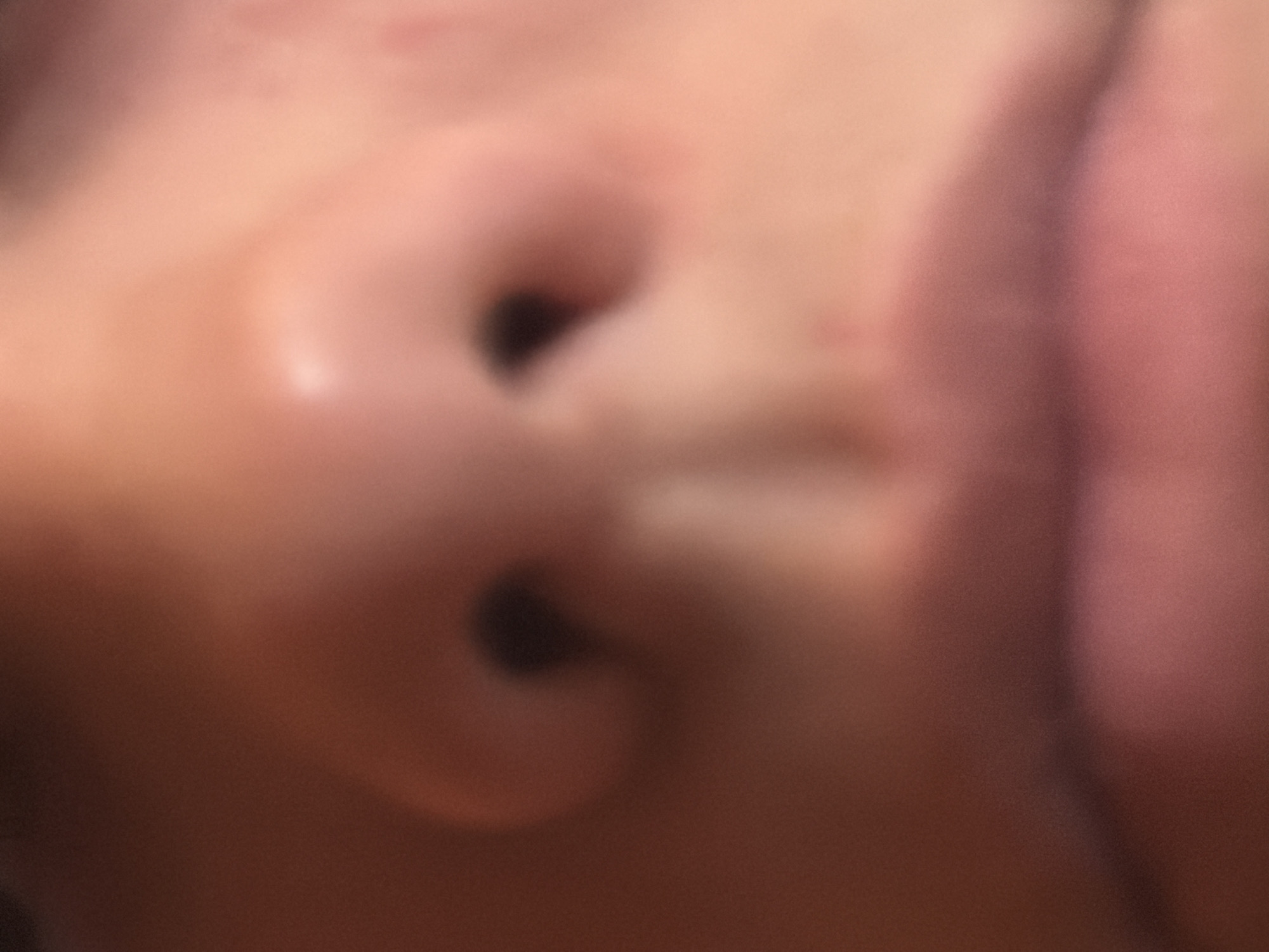 The image shows a close-up of a human nose and part of the mouth. The nostrils are visible as dark openings. The skin appears pinkish-beige and slightly blurred. There is no indication of the location being Sofia, Bulgaria, or any specific environment.