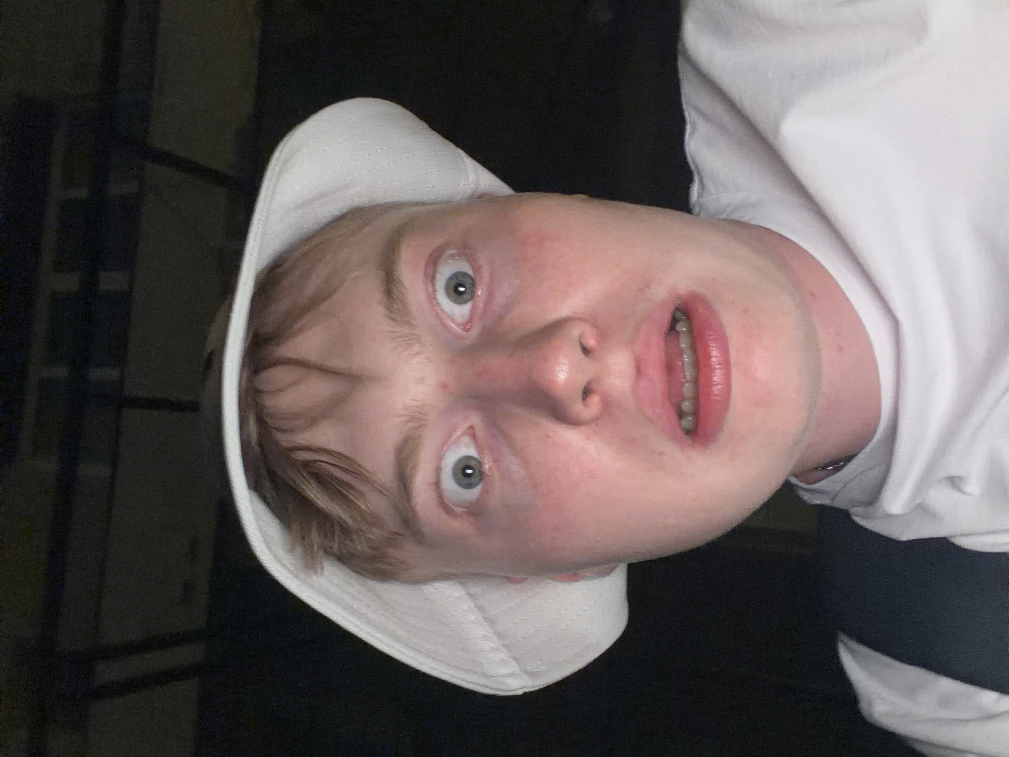 A close-up, low-angle selfie captures a person wearing a white bucket hat and a white t-shirt. The individual's mouth is open, revealing braces, and their eyes are wide, suggesting surprise or alarm. The background is dark and indistinct, with some vertical and horizontal dark shapes that could be part of a structure. There are no visible landmarks or identifying features that would indicate a specific location within Kyiv, Ukraine, or any other city. The lighting is dim, and the overall impression is that the photo was taken in a poorly lit indoor or outdoor environment.