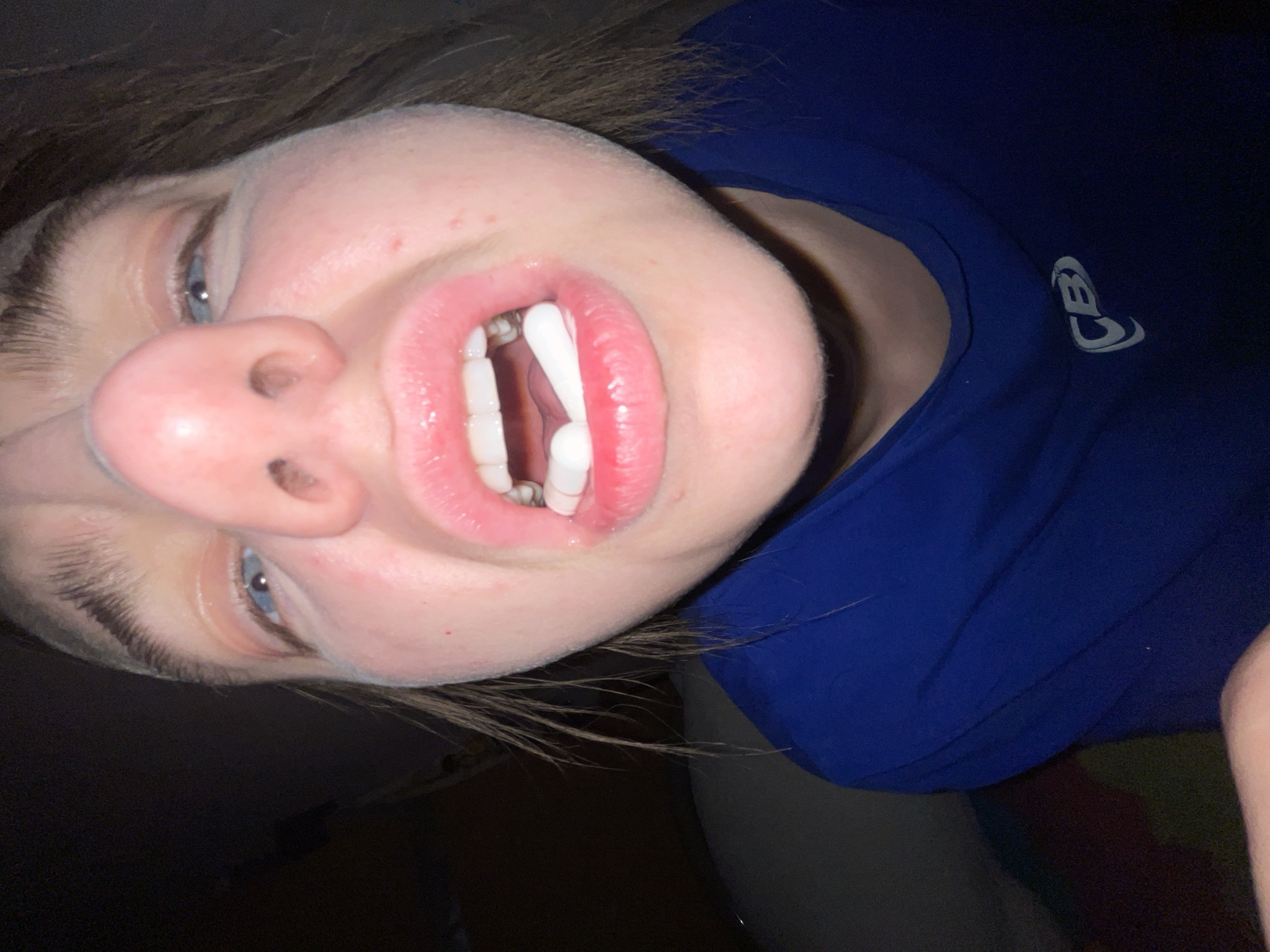 A close-up, slightly distorted view of a person's face. The person is wearing fake vampire teeth and has light-colored eyes. They are wearing a blue shirt with a logo. The background is dark and indistinct. The photo appears to have been taken at an unusual angle. There is no indication of the location being Moscow, Russia.