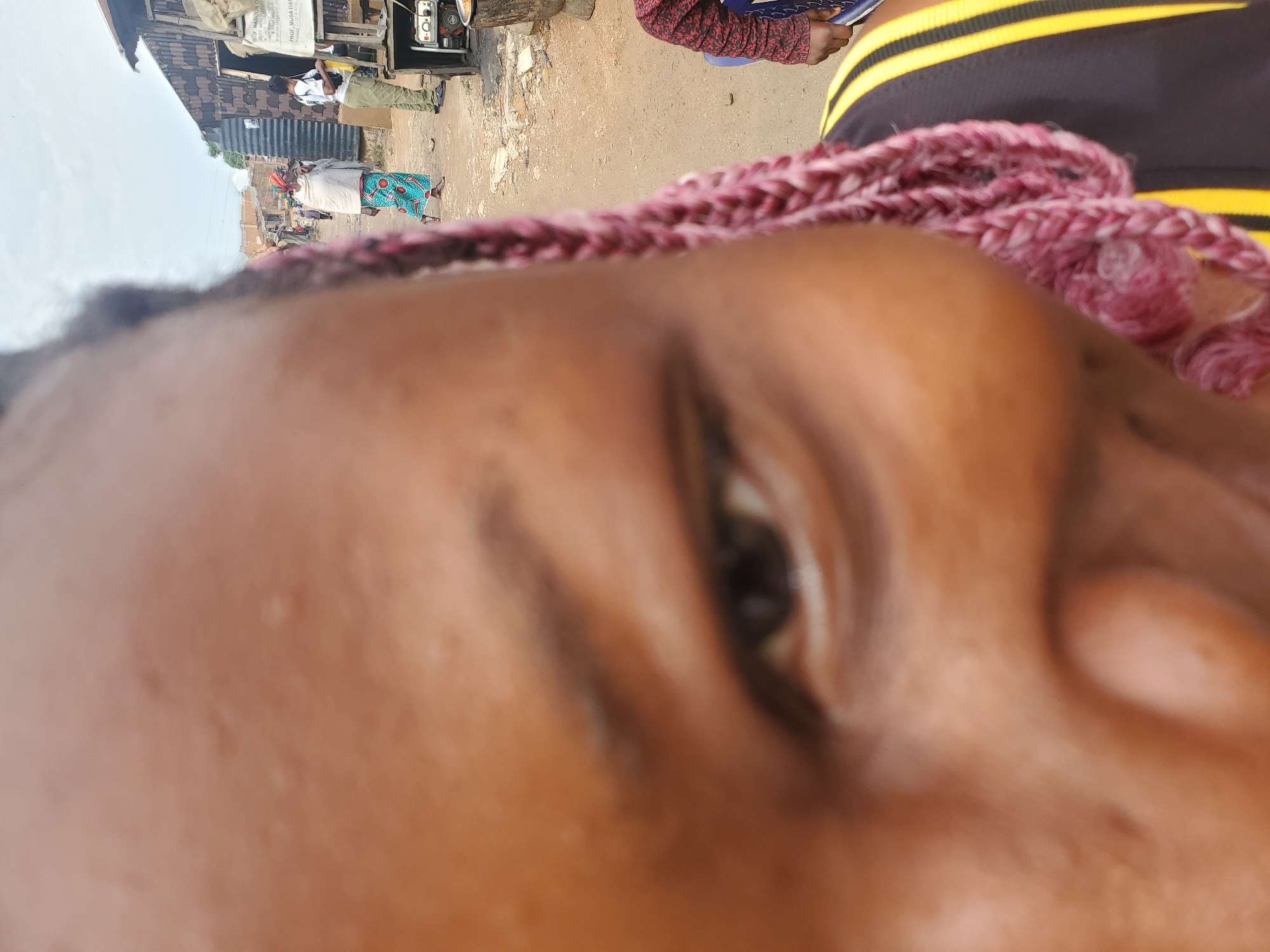 The image is a close-up, Dutch angle shot of a person's face, predominantly focusing on their eye and forehead, with their braided hair in the foreground. In the background, a street scene unfolds, suggesting a market or a busy thoroughfare in Jos, Nigeria.
The background shows several individuals and stalls. To the left, a structure resembling a makeshift shop with a corrugated metal roof is visible, with some posters or signage on its side. A person wearing a white shirt and khaki pants stands near this structure. Further down the street, other people are seen, including a woman in a colorful skirt and headscarf. The ground appears to be a dirt or paved road, typical of many urban areas in Nigeria.
The lighting suggests it is daytime, likely morning or afternoon, with overcast conditions contributing to the soft light. The overall atmosphere seems to be that of a bustling everyday scene. No overt emotions are discernible from the close-up on the face due to the extreme cropping and focus.
One discernible piece of text is visible on a sign on the stall in the background, appearing to be in English and possibly French. Part of it reads "PROGE. MUSA..." suggesting a name or project.
The dominant subject of the image is the person whose face is in the foreground. Their dark, braided hair is a prominent feature, positioned across the frame. The eye is open and looking towards the viewer, though the focus is soft. The skin tone is dark. The person is wearing a black and yellow striped garment, partially visible.