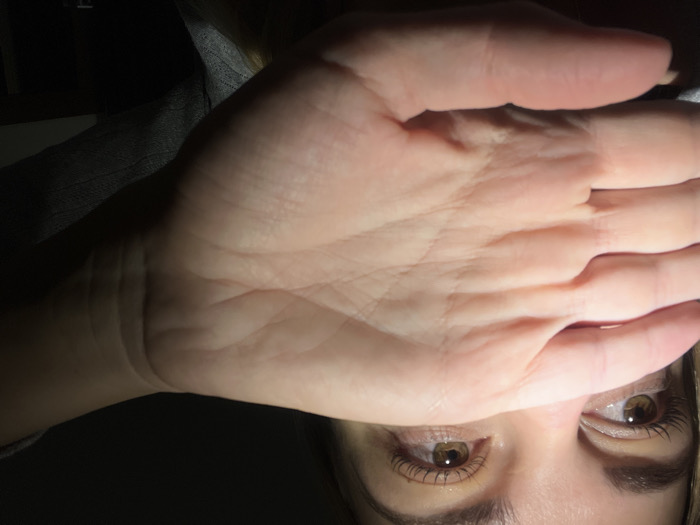 The image displays a person's face partially obscured by their hand. The hand, in the foreground, is pale and blocking the upper part of the face. Visible are the eyes, with light brown irises and dark lashes, and the eyebrows. The person appears to be looking directly at the viewer. A soft light illuminates the hand and the face.