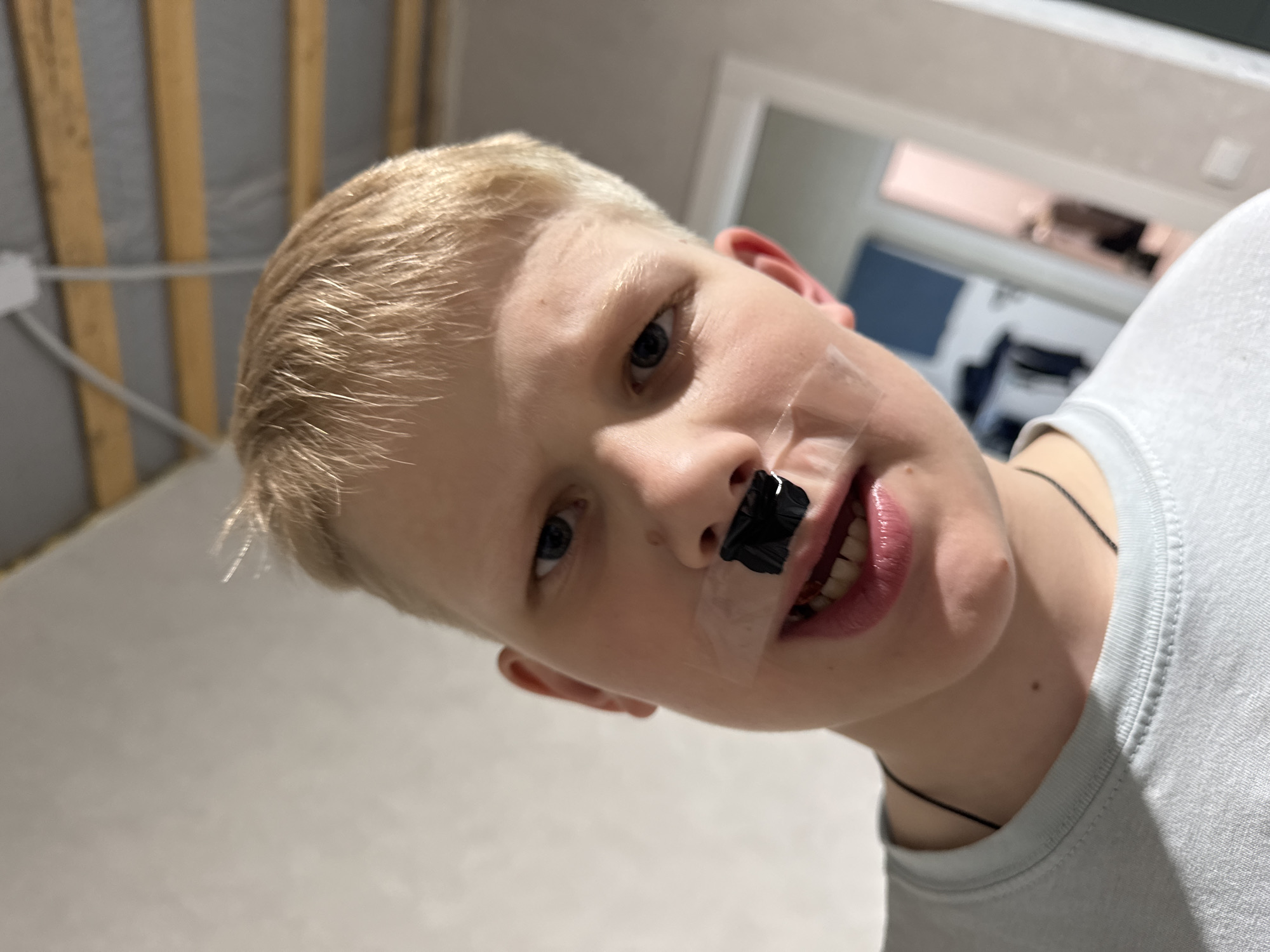 A close-up, angled shot of a young boy with blond hair, light skin, and light eyes. He is wearing a white t-shirt and a thin, dark necklace. Clear tape is attached to his face, spanning from above his upper lip to his nose, with a small, square-shaped piece of black material (possibly tape) adhered to the center of the tape over his nose. The boy is looking directly at the camera with a slight smile, showing his teeth.
The background is slightly blurred and appears to be an interior setting. In the upper left, there are light-colored wooden beams against a gray wall. Through a doorway in the background, a glimpse of a room with light walls and a window or light source can be seen.
The location is presumed to be Gornyi (Dvurechenskoe S/P), Russia.