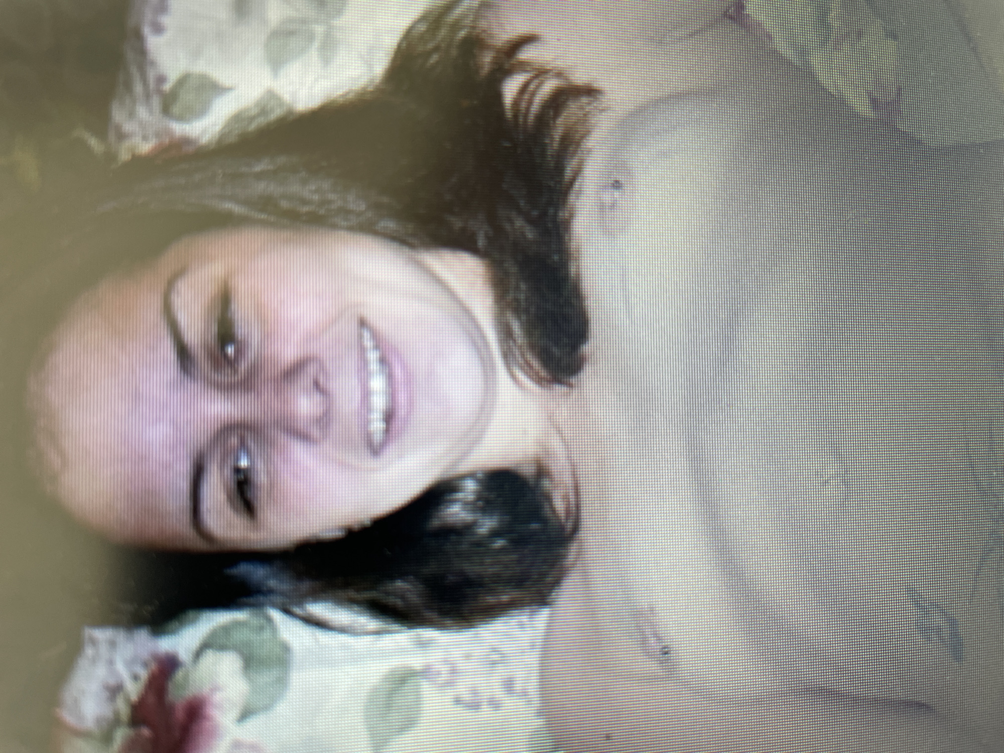 The image is a close-up, somewhat blurry photograph of a young woman lying on her back. She has dark hair, brown eyes, and is smiling. Her chest is partially visible, and there appear to be surgical scars on her breasts. She is wearing a light-colored garment that is not fully visible. The background consists of a floral patterned fabric, possibly a bedspread or pillow. The image quality is low, with visible pixelation. There is no indication of the city of Sevlievo, Bulgaria, or any other specific location within the image.