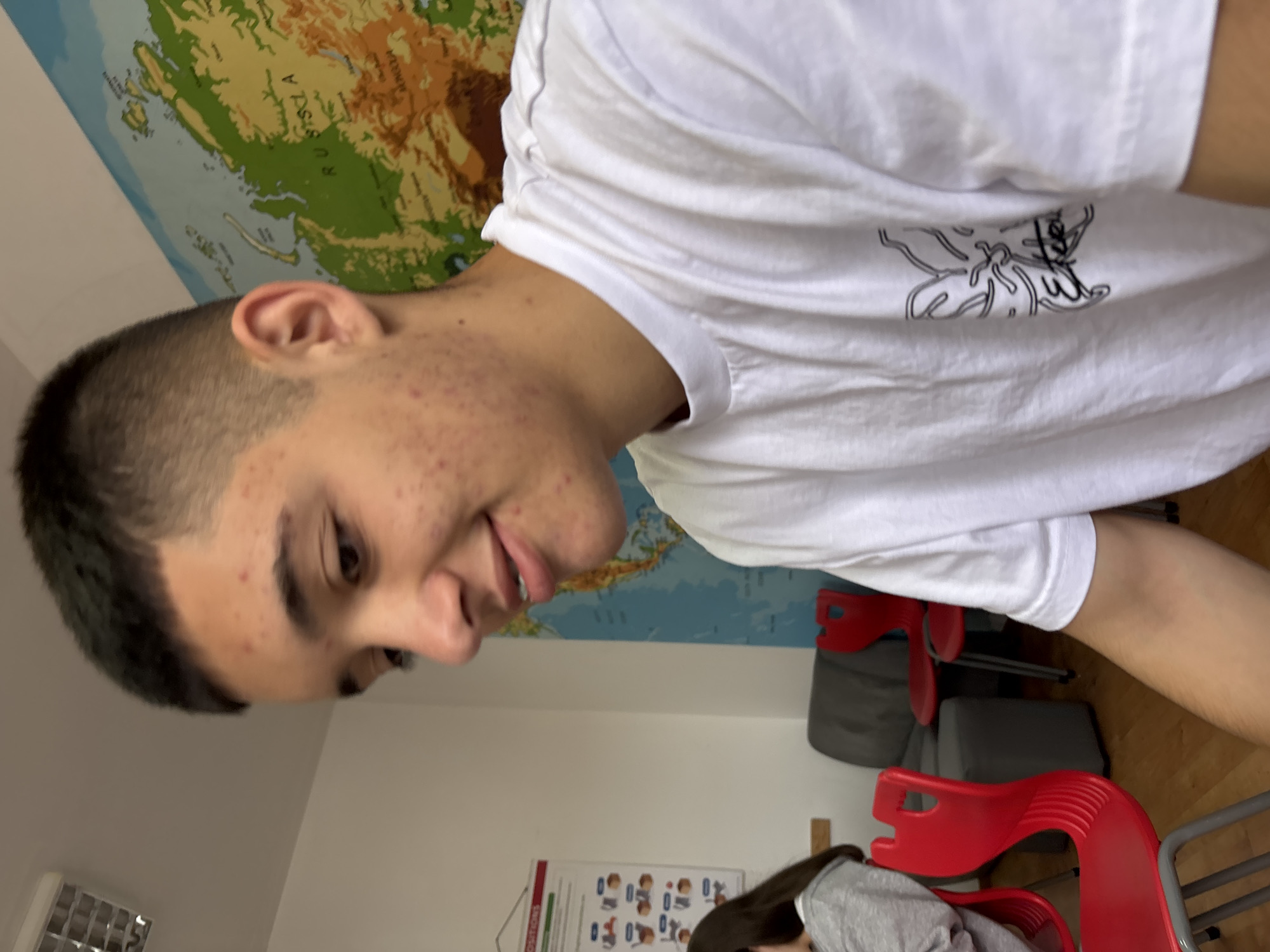 A young male, appearing to be in his late teens, is shown in a close-up, profile view, looking downwards and slightly to his left. He has short, dark hair and noticeable acne on his face. He is wearing a white t-shirt with a black graphic design. The background suggests an indoor environment, possibly a classroom or office, with a world map on the wall behind him. A glimpse of a red chair and a grey seating area is visible on the left side of the frame. The overall lighting is bright, indicating an interior setting. The image's context does not provide any specific information about the city of Zlatograd, Bulgaria, or any specific location within it.