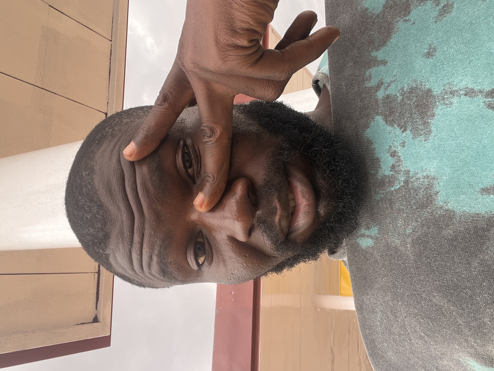 A close-up, slightly angled portrait shot shows a man with dark skin, a short haircut, and a full, neatly trimmed black beard. His right hand, also dark-skinned, is positioned on his forehead, with his fingers spread apart. The man appears to be wearing a tie-dye shirt featuring grey and teal colors. The background is nondescript, with hints of exterior building elements and cloudy sky. The man's expression appears to be a neutral or thoughtful one, with his eyes focused on something out of frame. There is no indication as to whether this photo was taken in Barakin Lerawi, Nigeria.