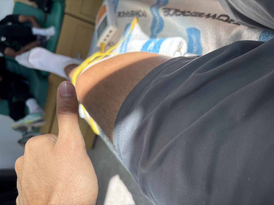 A person's leg with yellow wires attached is visible, resting on a blue and white towel. A white medical device sits nearby. In the background, another person is seen with a white sock and a light green shoe. The primary subject gives a thumbs-up, with their hand visible. The person's gray shorts are wrinkled and in focus. The scene suggests a medical or therapeutic setting.