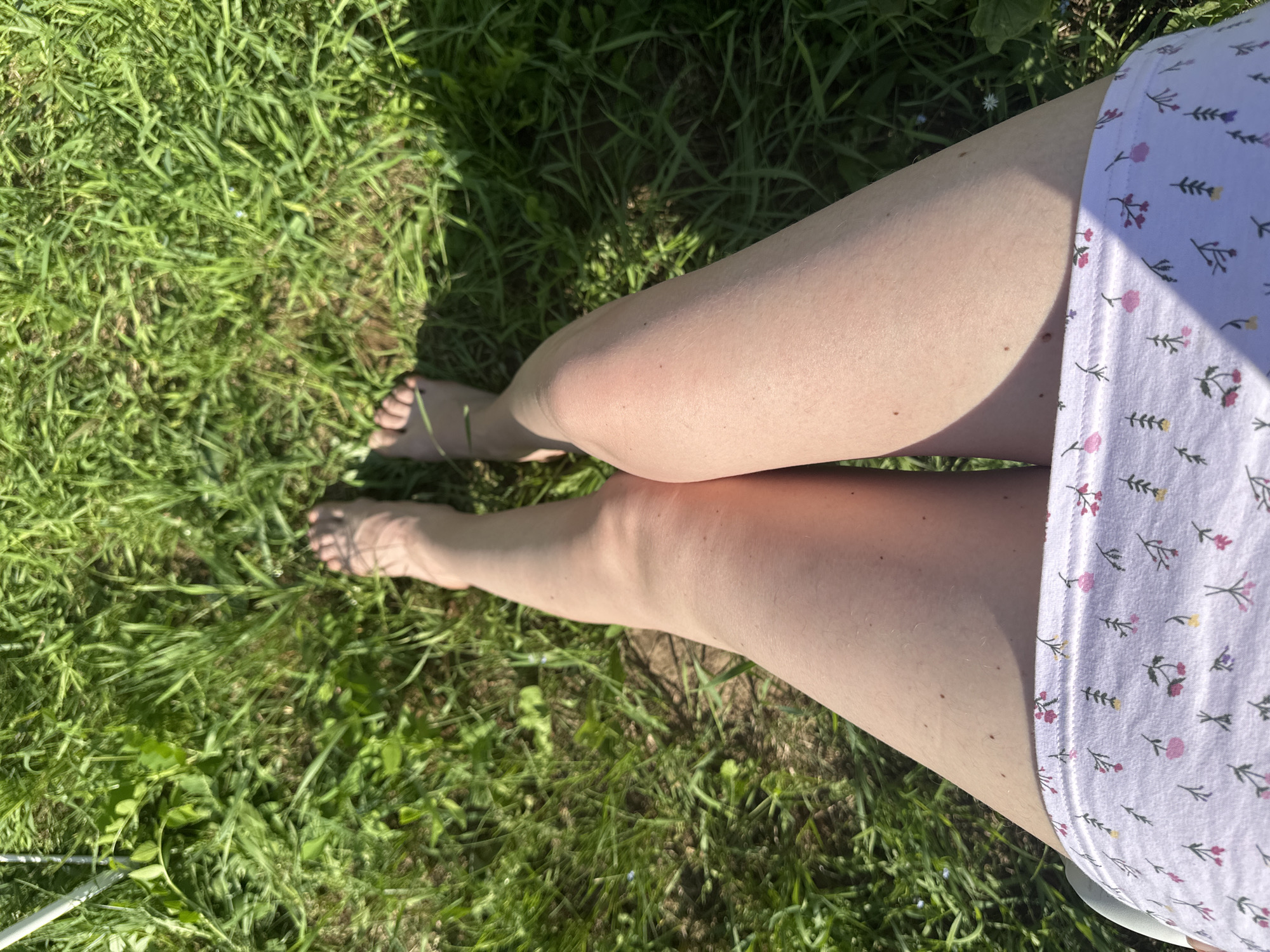 An overhead shot shows a person's legs and feet in green grass. The person is wearing a white garment with a floral print. The sunlight casts shadows on the grass, suggesting it is daytime. The location is implied to be a park or backyard in Mokino, Russia. The scene is peaceful and natural, with no other people or objects visible.