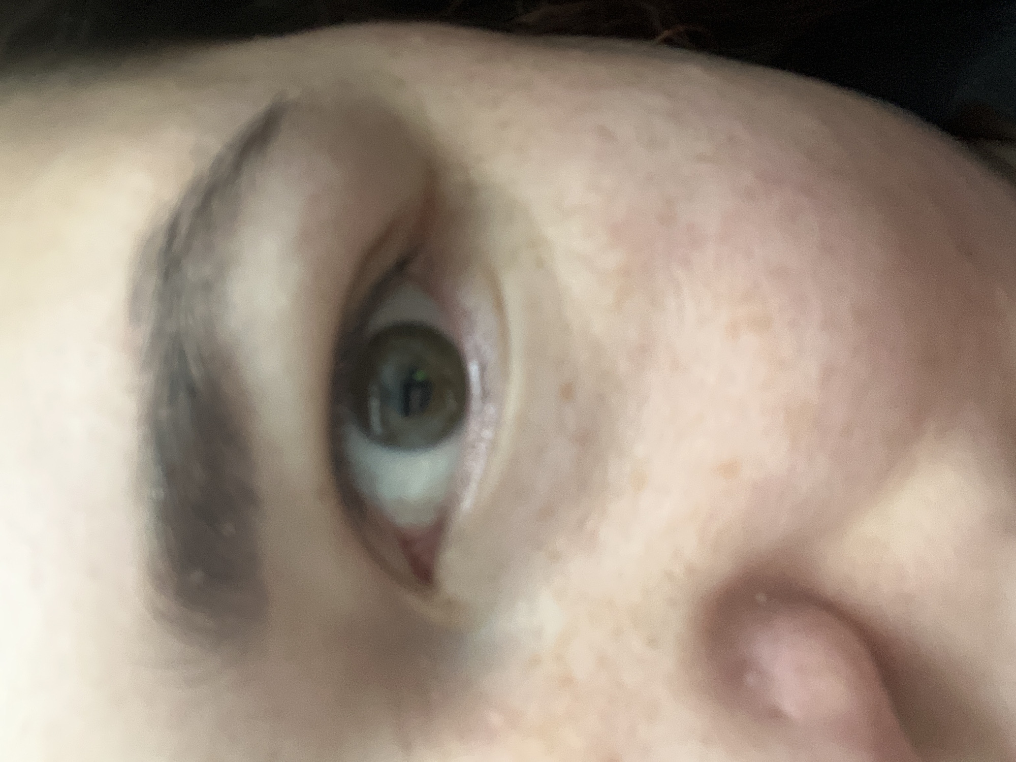 The image is a close-up, partially blurred photograph of a person's eye and surrounding facial features. The eye is open, with a green iris and a dark pupil. The eyebrow above the eye is dark and appears to be well-groomed. The skin has a light to medium tone with visible freckles and some redness. The nose is partially visible on the left side of the frame. The background is dark and out of focus. There is no information available to place this image in the city of Chelyabinsk, Russia.