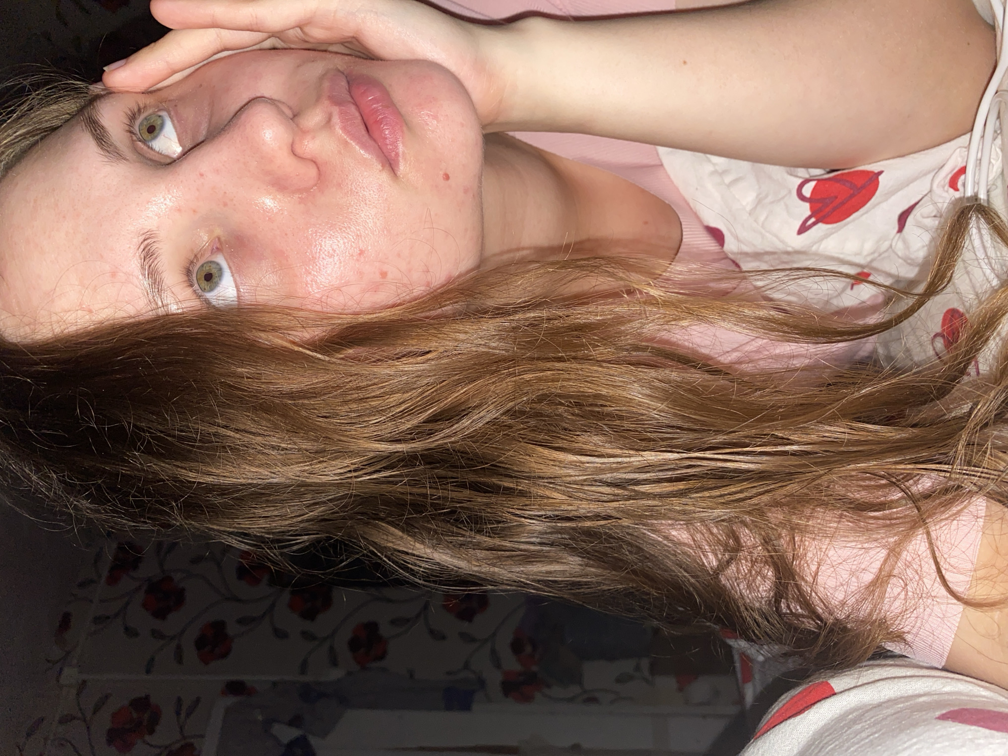 A young woman with light brown hair and green eyes is lying on a bed, propping her head up with her right hand. She is looking upwards and to the right. Her skin appears to have some redness and blemishes. She is wearing a pink shirt. The background shows floral wallpaper and a white blanket with red heart patterns. The scene is indoors and appears to be a bedroom. There is no discernible information about the city of Вассята, Russia, within the image.