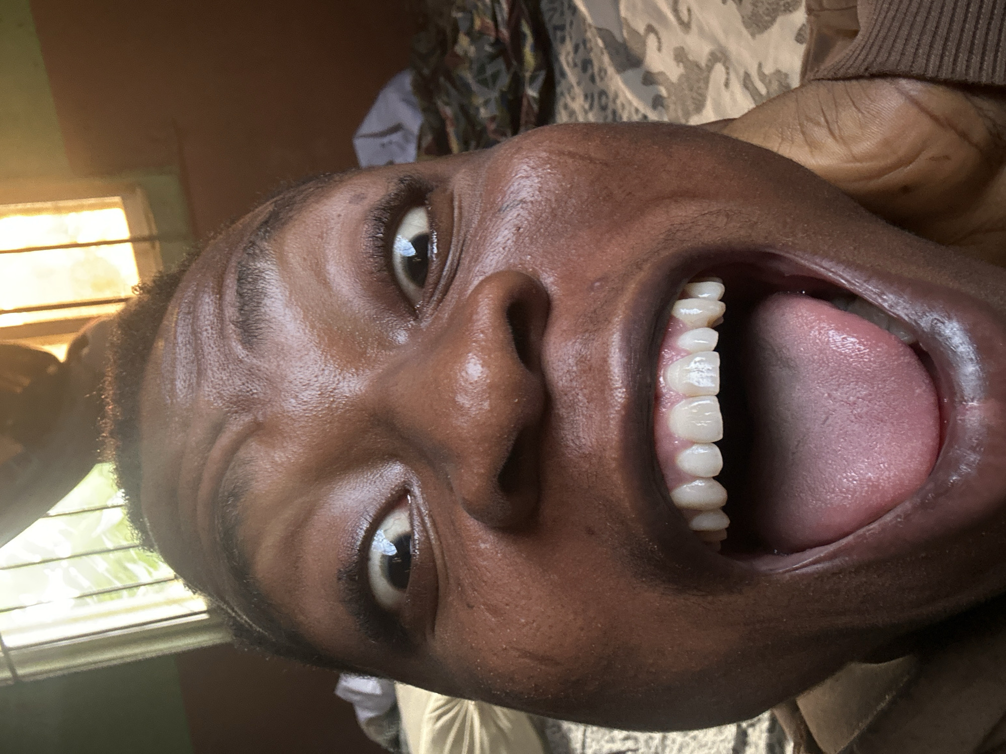 A close-up, tilted upward shot depicts a person with dark skin and an open mouth, revealing their teeth and tongue. The person's eyes are visible, and their facial expression is intense. The background is blurry but suggests an indoor environment, possibly near a window. The location is not discernible from the image.