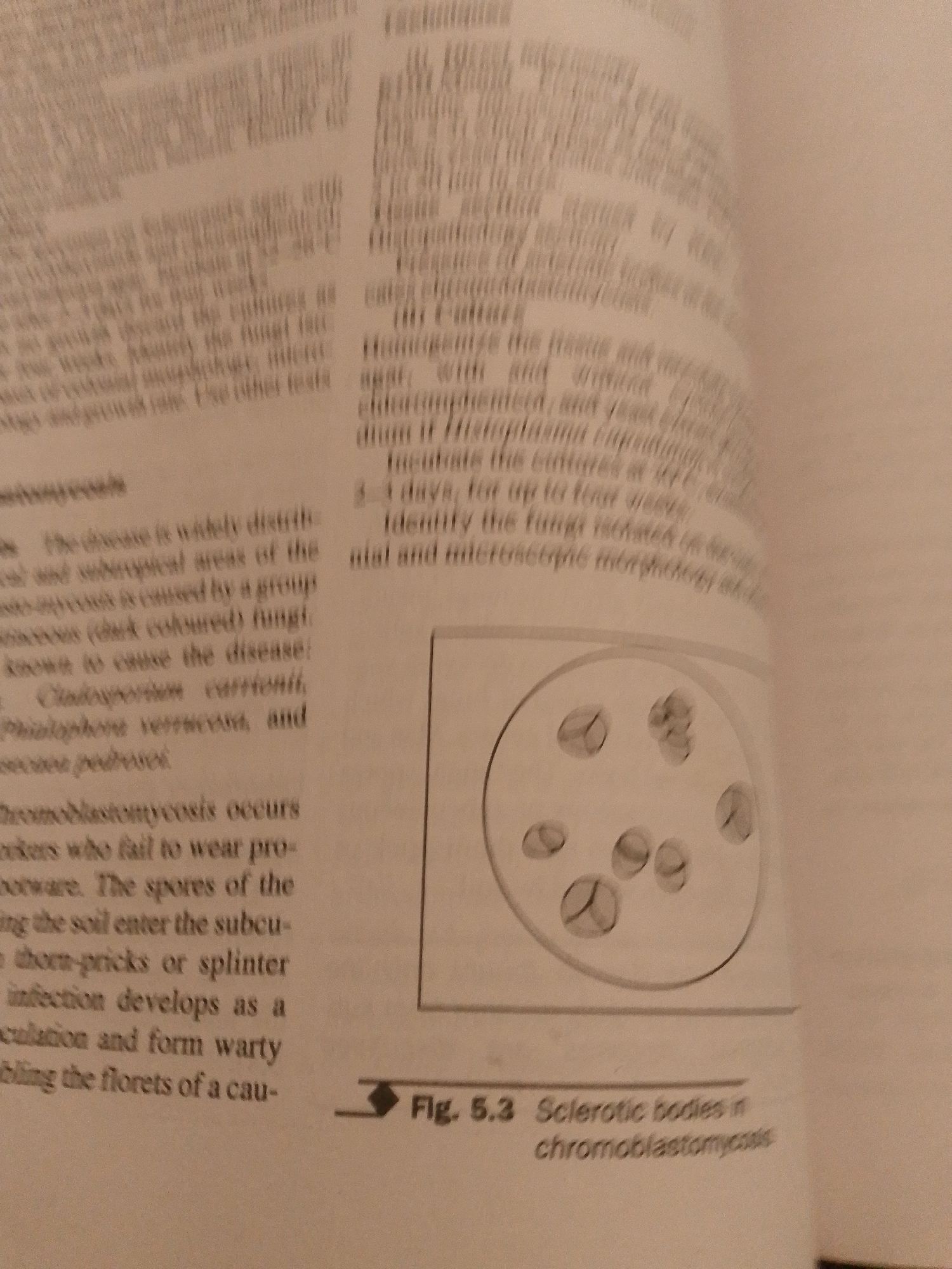 The image is a photograph of an open book, likely a textbook or scientific publication, with text and an illustration. The main subjects are the printed text and a diagram. The text discusses chromoblastomycosis, a fungal infection. It details the disease's distribution, causative agents (specifically mentioning _Cladosporium carrionii_, _Phialophora verrucosa_, and _Exophiala jeanselmei_), and how infection occurs through contact with contaminated soil, often via thorn-pricks or splinters. The text also touches upon laboratory identification methods, including incubation and microscopic examination. The illustration, labeled "Fig. 5.3 Sclerotic bodies in chromoblastomycosis," shows a circular diagram containing several oval shapes, which are identified as sclerotic bodies. The scene is a close-up of book pages, with no indication of people, a specific time of day, weather, or emotions. The location context provided, Jauro Yinu, Nigeria, is not visually represented in the image itself. The visible text is primarily academic and medical in nature.