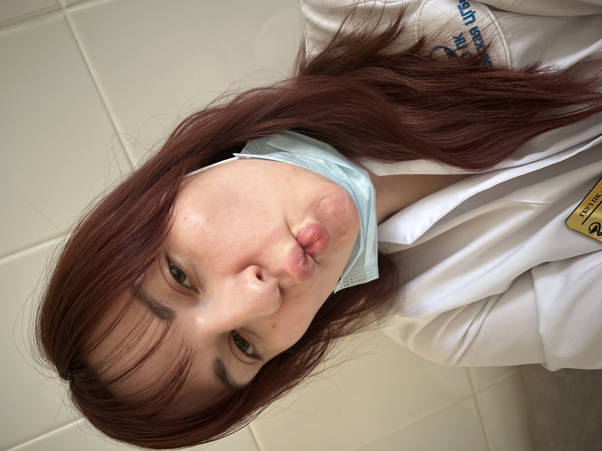 A tilted, close-up photograph features a person, likely a woman, with long, reddish-brown hair looking directly at the camera. Her face shows a playful "fish face" expression with pursed lips. She is wearing a white professional coat, suggestive of a medical or laboratory uniform, and a light blue surgical mask is pulled down to her chin. The background consists of plain, light-colored walls or tiles, indicating an indoor setting.
Visible details include blue Cyrillic text embroidered on the shoulder of the white coat, which appears to read "ГБУЗ ПК" (GBUZ PK) and "Икас ПК". A yellow lanyard or badge, also bearing "ГБУЗ ПК" in black Cyrillic text, is attached to her coat on the right side. This text, combined with the professional attire and the provided location context of Фоки, Russia, suggests the setting is a State Budgetary Healthcare Institution in the Perm Krai region of Russia. The lighting is bright and even, consistent with an indoor daytime environment. The image is captured from a low angle, looking up at the subject.
