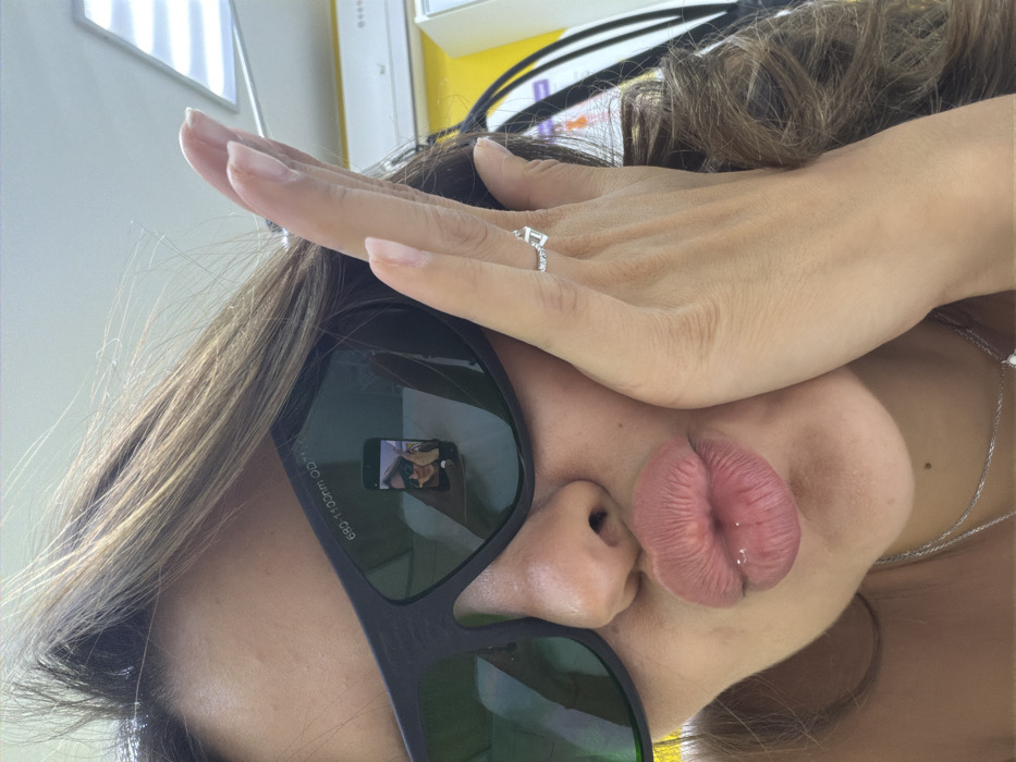 A woman takes a selfie wearing laser safety glasses, which reflect a glimpse of the phone's screen. Her lips are pursed. An engagement ring sparkles on her finger as her hand rests on her forehead. A silver necklace is visible near her collarbone. Her hair is brown with blonde highlights. The background consists of office elements, with a yellow surface and white fixtures partially visible.