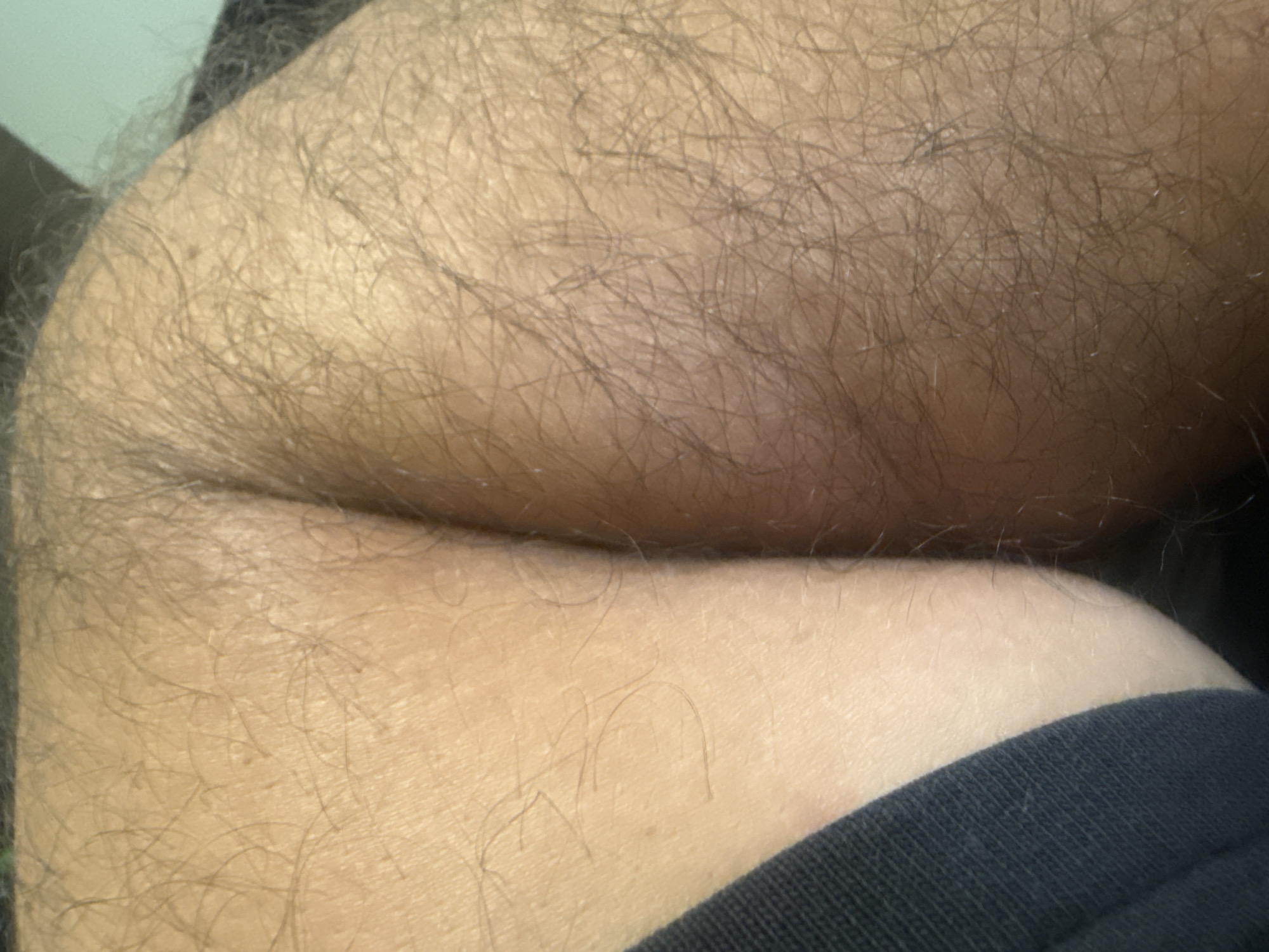 The media file is a close-up, overhead shot of human skin, likely an arm or leg, based on the visible texture and hair. The skin is lightly tanned and covered in a dense layer of dark hair, with some areas appearing more sparsely populated with hair than others. The texture of the skin itself is visible, with pores and subtle lines. A creased area, possibly a joint like an elbow or knee, is prominent in the center of the frame, creating a shadow and highlighting the skin's contour. The lighting appears to be from above and to the left, casting soft shadows. A dark fabric, likely clothing, is visible along the bottom edge of the frame. There is no text visible in the image. The setting is intimate and personal, focusing solely on the details of human skin.