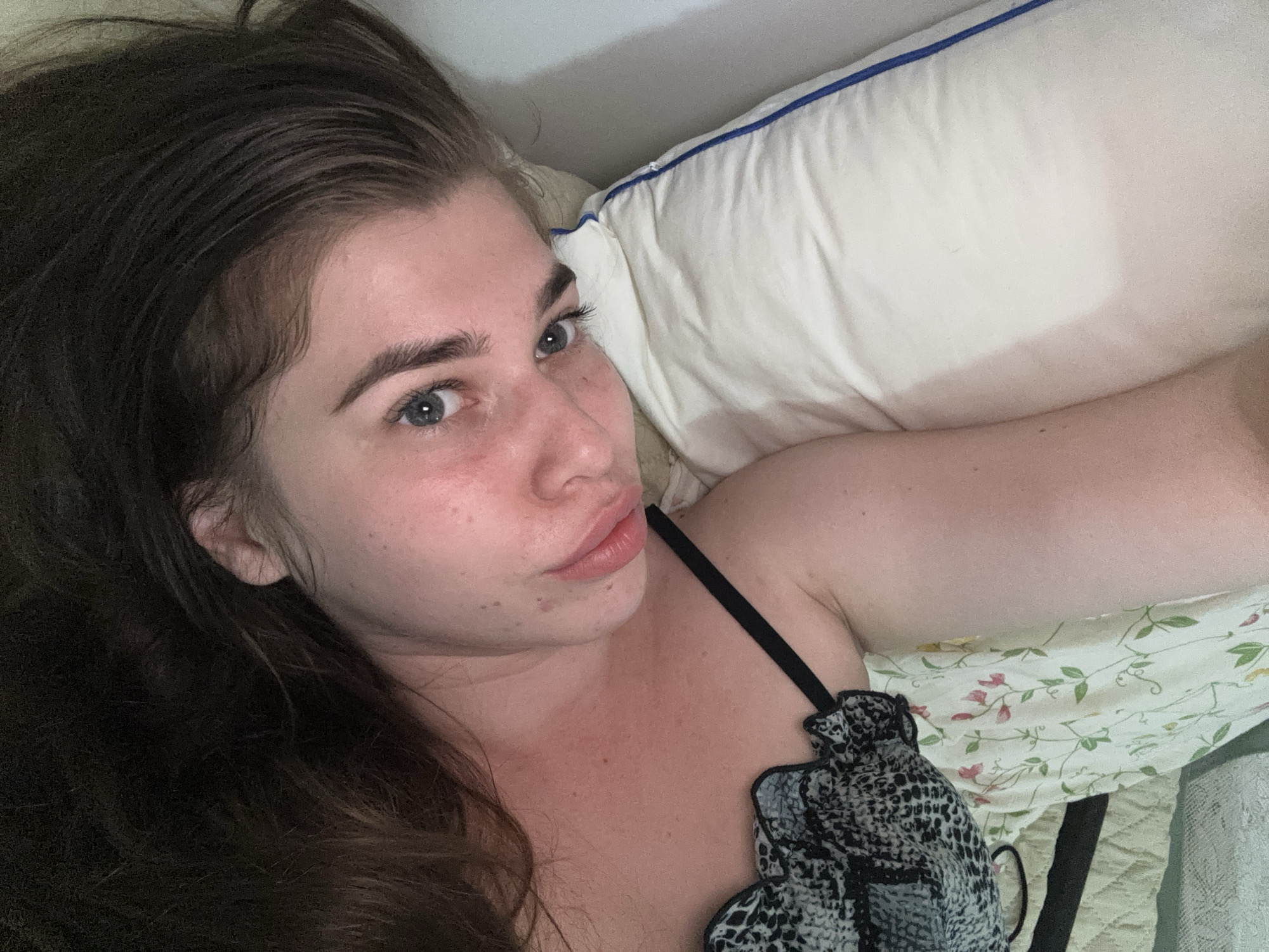 An overhead, low-angle shot captures a person lying on their side on a bed in Мещёры, Russia. The person's head is tilted back, exposing their face. They have medium-length, dark brown hair, blue eyes, and fair skin with some redness, suggesting a blush or sun exposure. The person is wearing a black and white patterned top with a ruffled neckline and a black strap. They are lying on a white pillow with blue trim, and a floral-patterned sheet is visible in the background. The scene appears to be a casual, indoor setting.