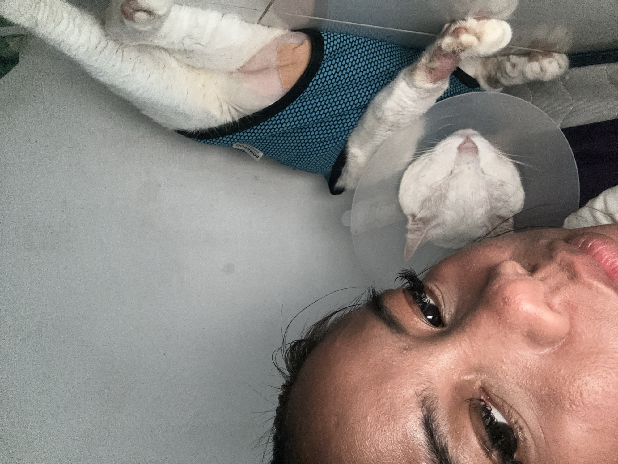 A person with dark hair and eyelashes is lying on a gray surface, taking a selfie. Next to them is a white cat wearing a blue mesh shirt and a cone around its head. The cat's left leg is bandaged. The setting appears to be indoors.