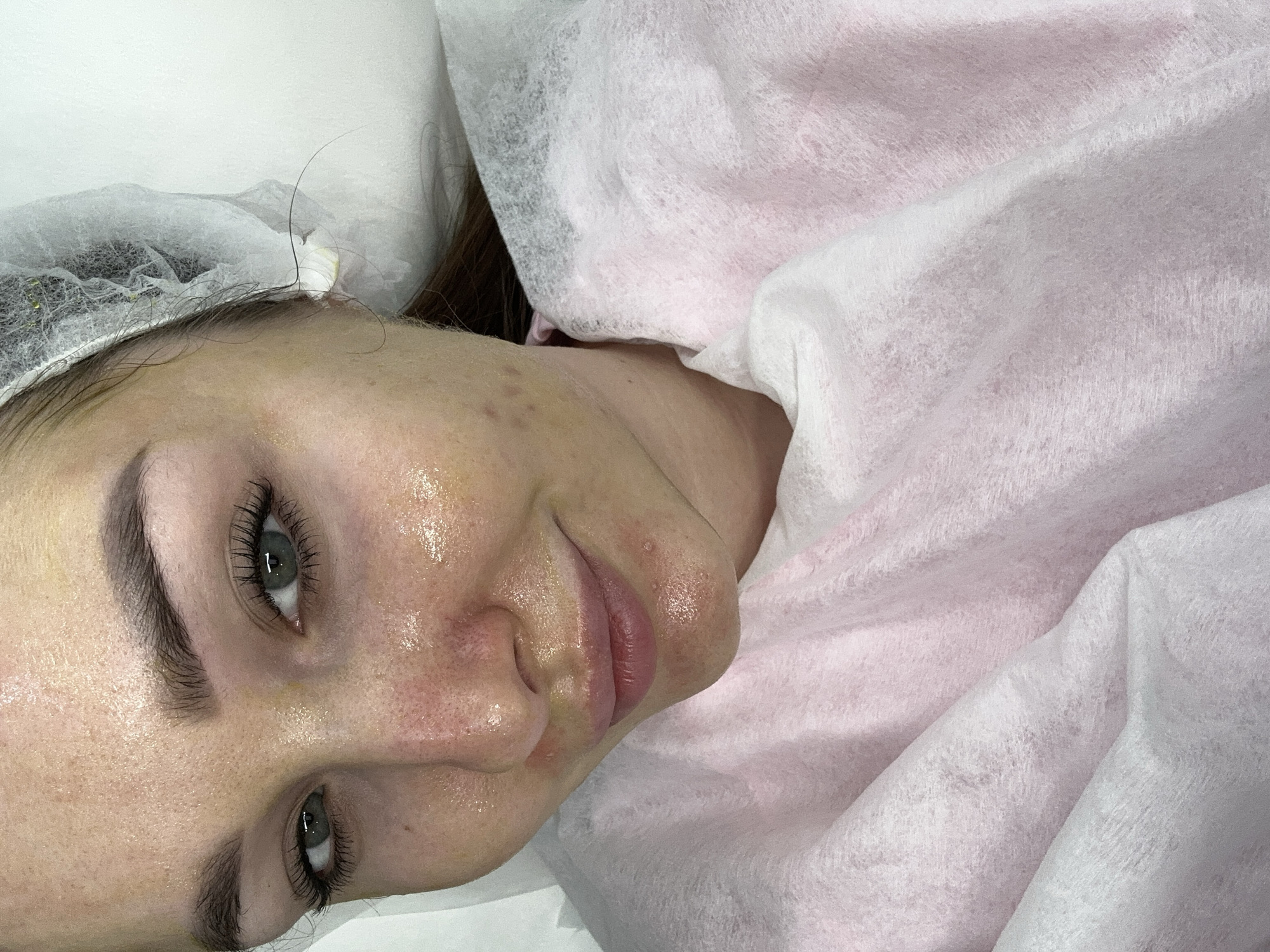 A woman lies on her back, partially covered in a white and pink surgical drape. She is wearing a disposable hairnet. Her face appears to have a slight sheen, possibly due to skincare products. The location is Chaikovsky, Russia, based on prior context. No specific building or street is visible. The scene suggests a spa or medical setting.