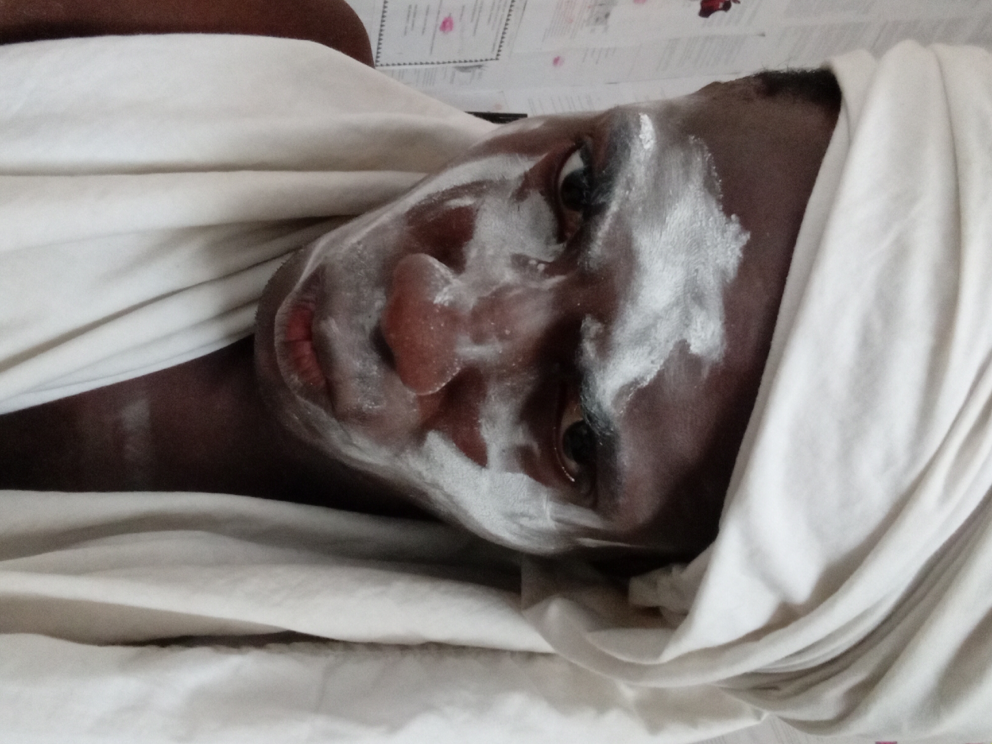 A close-up shot presents an individual lying down, possibly on a bed or examination table, covered with a white cloth or sheet. Their face is visible, bearing what appears to be white cream applied across the forehead, cheeks, nose, and chin. The person has dark skin, and their eyes are open. The background is indistinct, but there is a wall behind the person. The photo was taken indoors. The location in the city of Akwete, Nigeria, cannot be ascertained from the image alone.