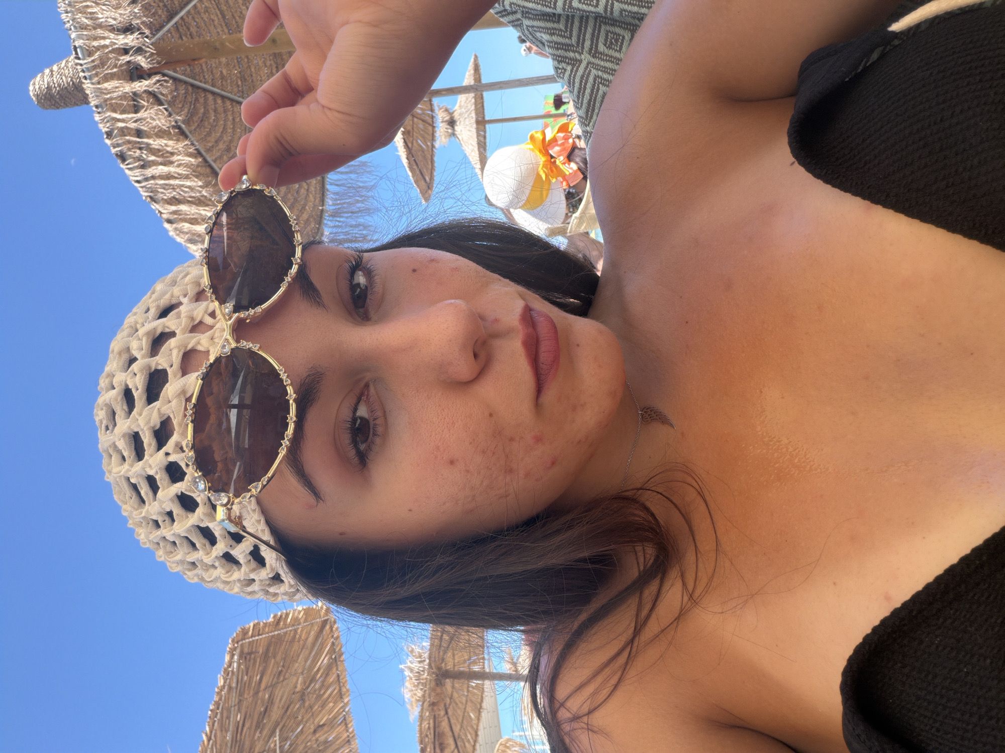The image is a close-up selfie of a young woman on a beach. She is wearing a crocheted hat and sunglasses, and her hair is dark. The background shows beach umbrellas and a clear blue sky. The woman has acne on her face and some sun tanning on her chest. She is holding her sunglasses with her right hand. The location is identified as Varna, Bulgaria.