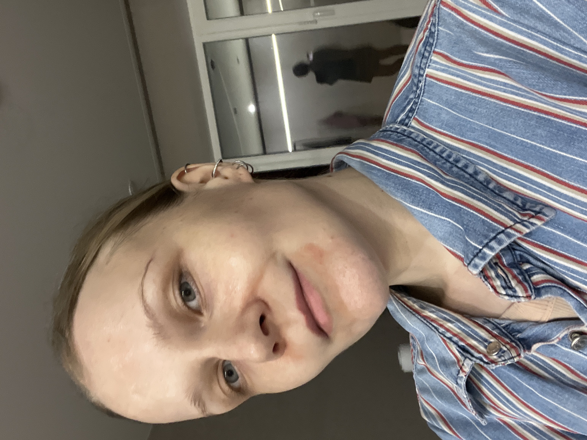 A close-up, angled selfie photograph shows a fair-skinned person with light brown hair and blue eyes. The person's face displays some redness around the cheeks. They are wearing a blue and white striped shirt with red accents. The top button of the shirt is fastened. In the background, visible through a window, is a dark figure, possibly a reflection. The location appears to be indoors.