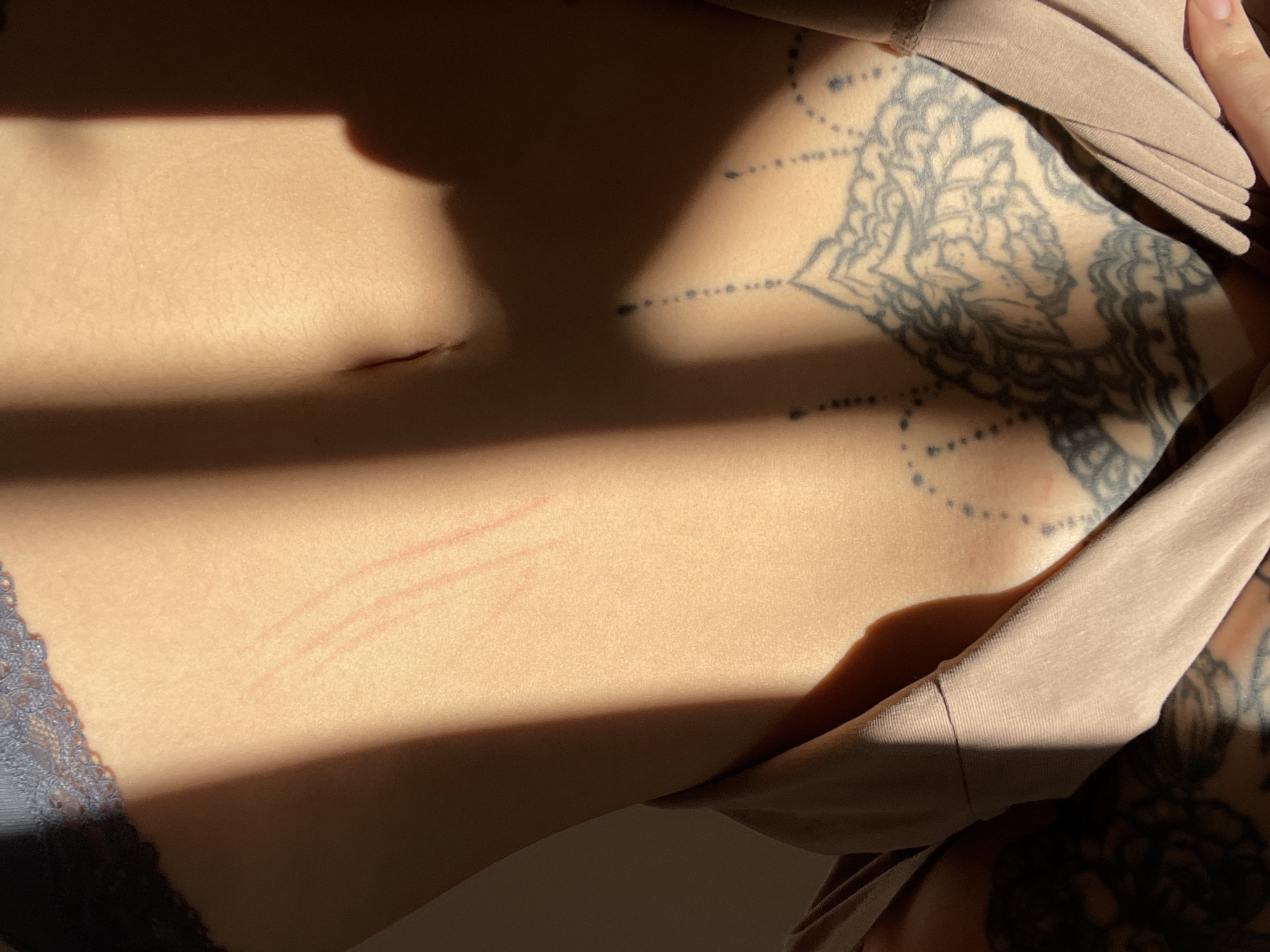 The image captures a close-up of a person's torso, specifically the midsection and upper abdomen, illuminated by natural sunlight that creates strong, angular shadows. The light suggests it is morning or late afternoon.
The primary subject is a person's skin, which has a warm, light tone where touched by the sun. On the upper right side of the torso, extensive tattoos are visible. These tattoos feature intricate, dark grey or faded black ornamental patterns, resembling mandalas or floral designs, covering a significant area.
Garments include a light beige or nude-colored fabric, possibly a top or bra, pulled up on the right side, revealing more of the tattooed skin. On the lower left, the edge of a dark grey or blue lace fabric, likely from underwear, is visible.
Notable details on the skin include several parallel, reddish linear marks or scratches on the lower central abdomen. Higher up, on the upper left side of the abdomen, a small, horizontal scar or mark is present. The strong sunlight casts distinct shadows across the skin, emphasizing the contours of the body and the intricate tattoo work. No visible text is present in the image.
The scene appears to be an indoor setting, given the defined shadows suggesting light coming through a window. The location context is Boreti, Montenegro.