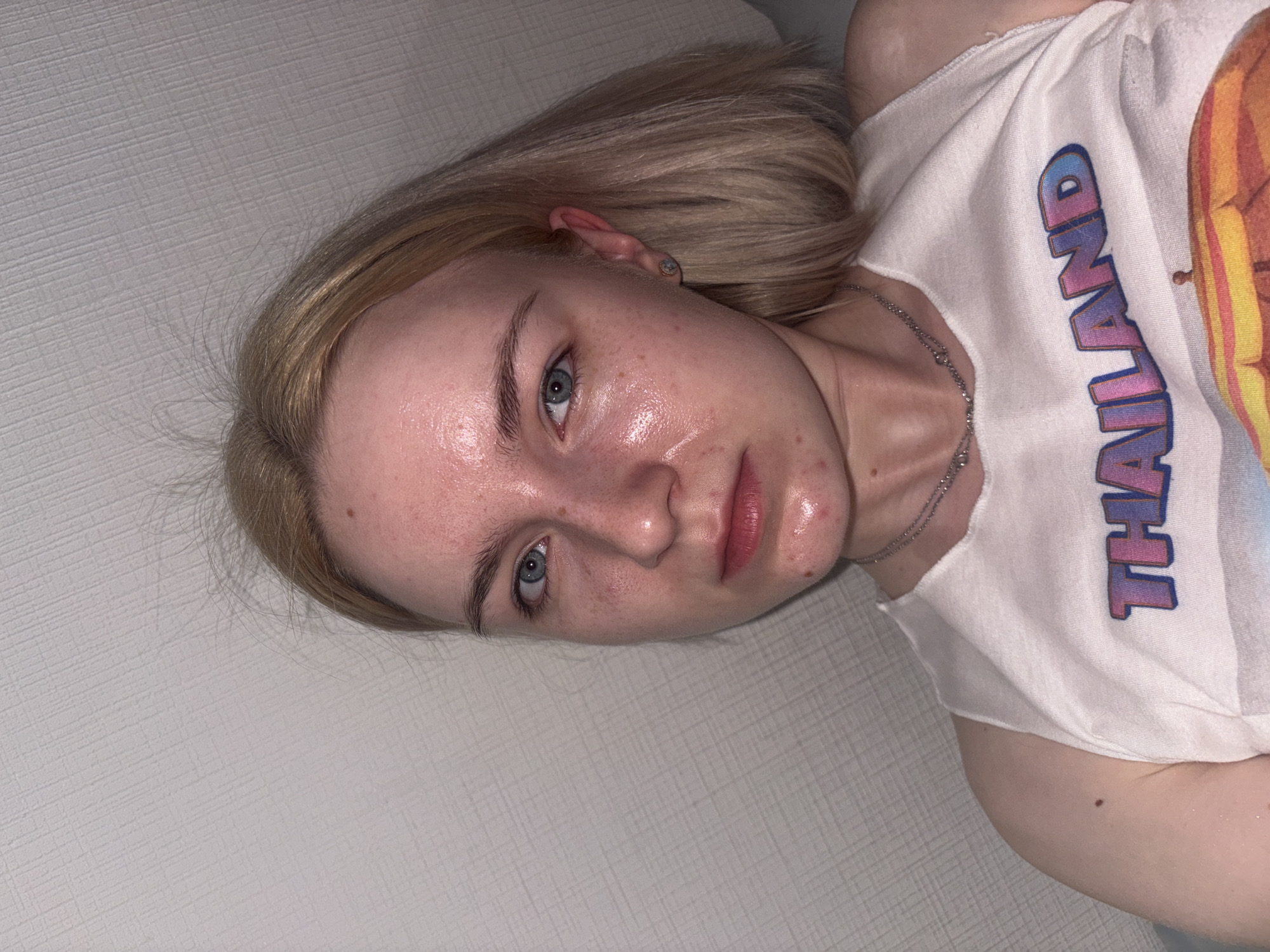A young woman with blonde hair and blue eyes is looking at the camera. She is wearing a white tank top with the word "THAILAND" printed on it in colorful letters. Her face is slightly shiny, and she has some red spots and blemishes on her skin, particularly on her chin. She is wearing a silver chain necklace. The background appears to be a textured wall with a light color. No city or country information is discernible from the image.