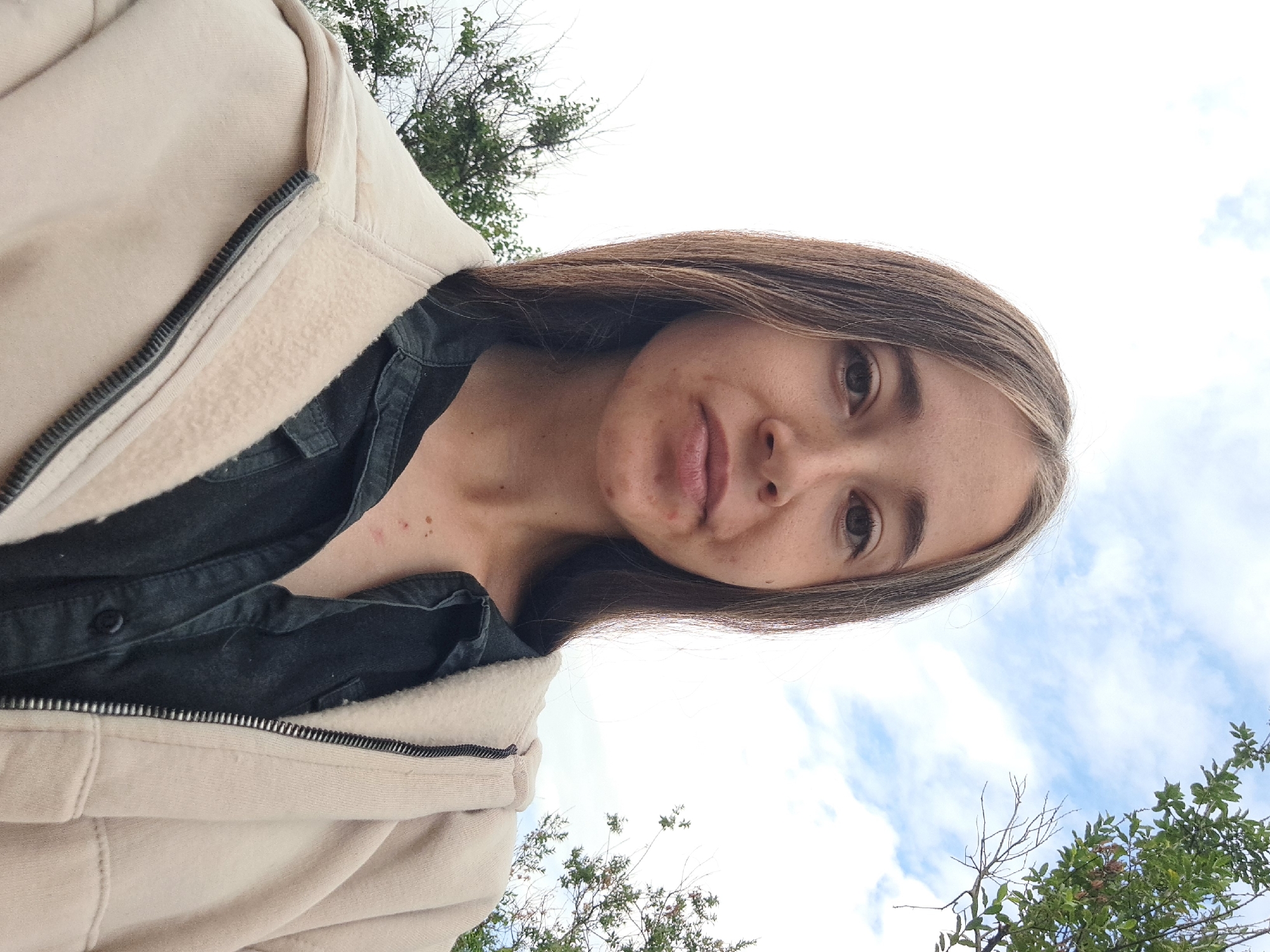 A waist-up, medium shot photograph captures a young woman from the shoulders up, against a backdrop of a partly cloudy sky and green foliage. She is looking directly at the camera with a neutral expression. Her hair, a mix of brown and lighter streaks, is long and falls down her shoulders. She is wearing a dark collared shirt underneath a light-colored hooded jacket that is partially zipped. The woman has some blemishes on her face and chest. The scene appears to be outdoors, with trees and branches visible in the upper right and lower left corners, suggesting a natural environment. The lighting is natural, casting a soft light on the subject. No specific landmarks of Vypasne, Ukraine are identifiable in the image.