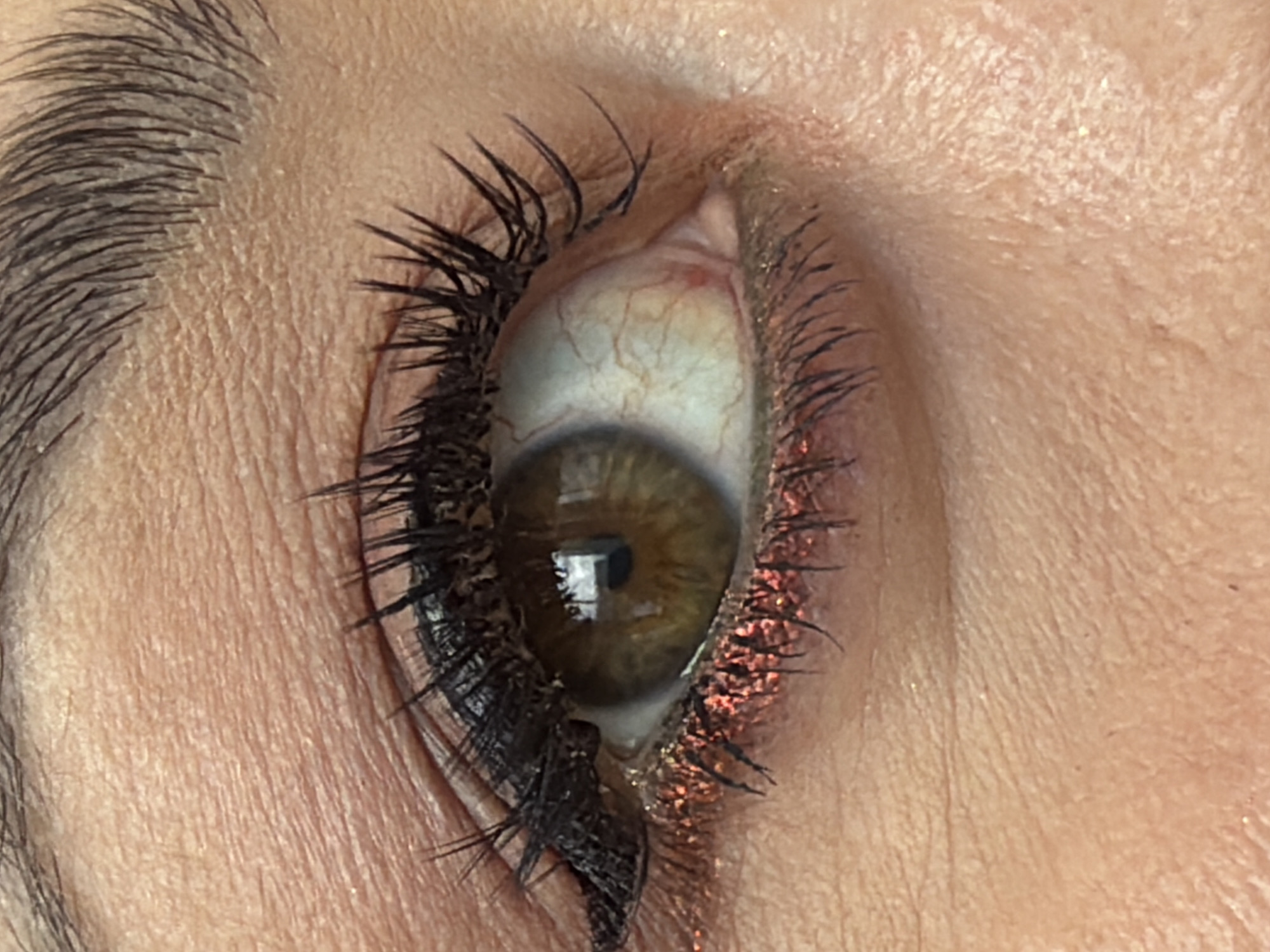 A close-up of a human eye, showing the iris, eyelashes, and surrounding skin. The iris is brown. The eyelashes appear coated with mascara. The skin around the eye shows texture and slight discoloration. There is no indication of the location being Krasnoyarsk, Russia.