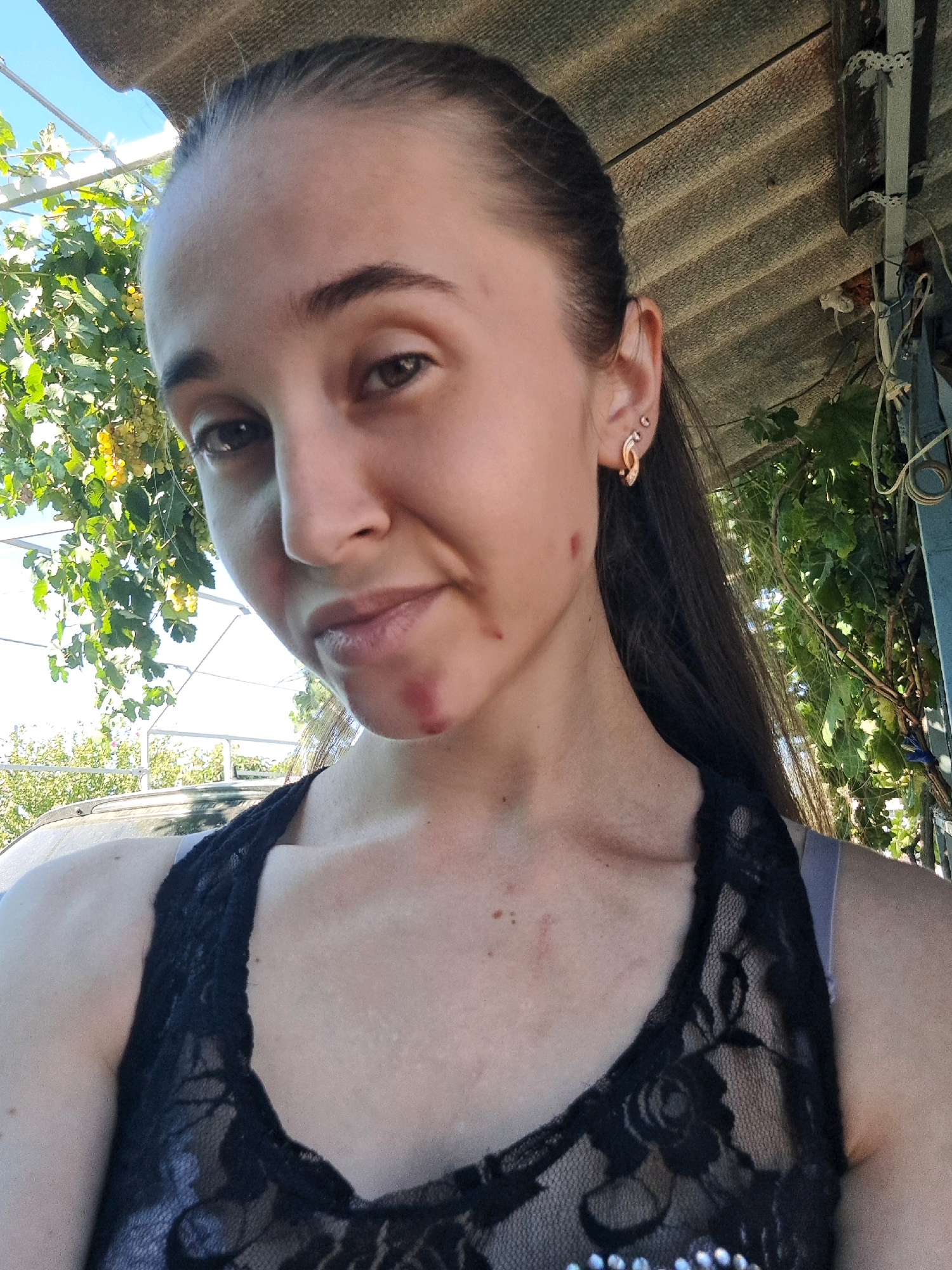 A young woman is captured in a close-up, outdoor, selfie-style photograph. She is positioned slightly off-center to the left, looking directly at the camera with a neutral expression. Her dark brown hair is pulled back into a ponytail, and she is wearing a black lace top with a grey bra strap visible. She has a small stud earring in her left ear and a more prominent gold-colored earring in her upper left earlobe. There are visible blemishes or marks on her cheek and chin, one appearing to be a healing scab or irritation.
The background features lush green foliage, likely from a vine or tree, with some yellowing grapes visible. Above the woman, a corrugated roof structure is present, suggesting an outdoor shelter or awning. The overall lighting indicates a bright, sunny day. The image appears to have been taken in the city of Vypasne, Ukraine. A portion of a car's windshield or hood is visible in the lower left corner.