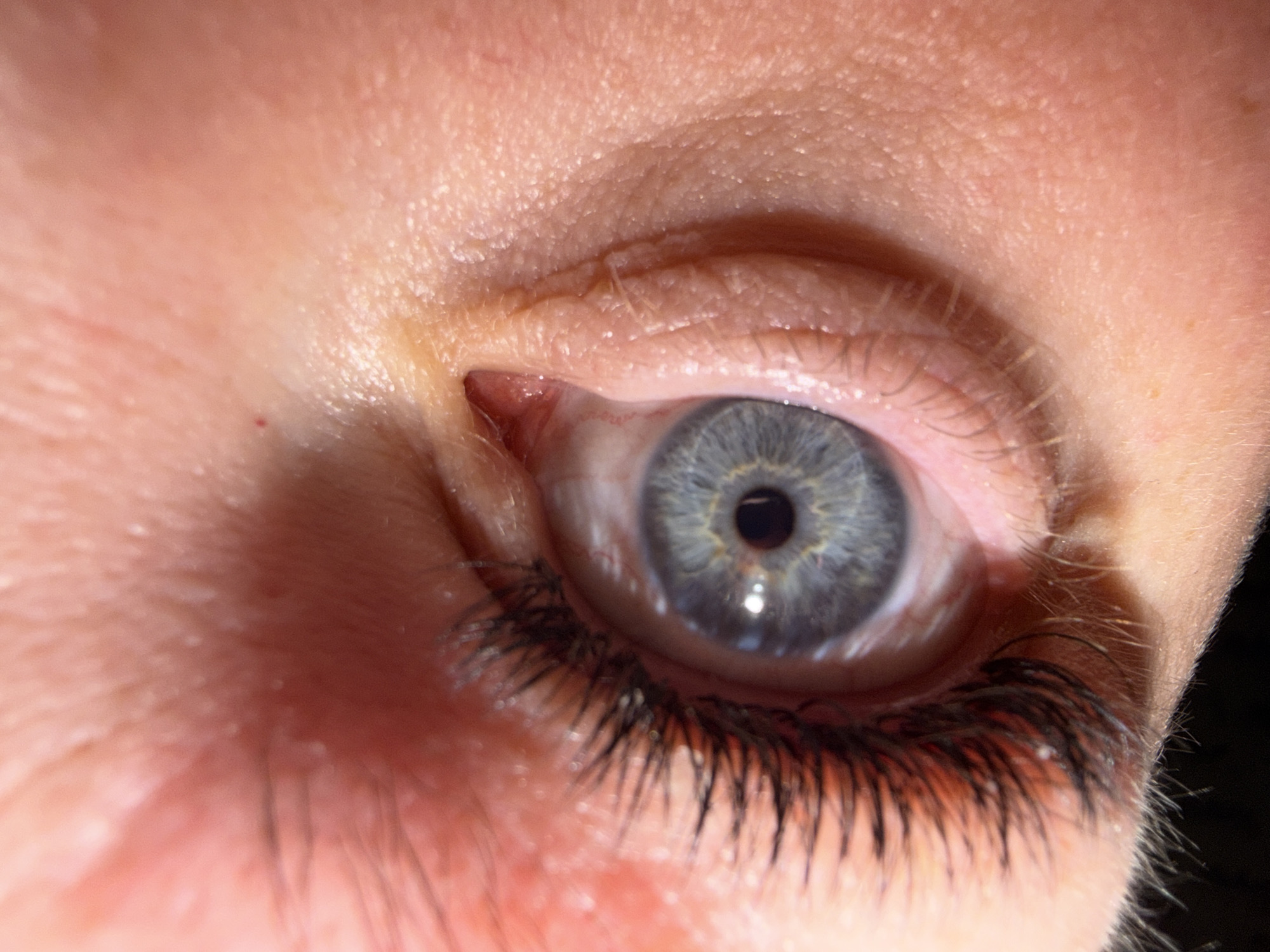 A close-up shot of a human eye, specifically the left eye, appears to be the primary subject. The eye has a gray iris and black eyelashes. The surrounding skin exhibits fine wrinkles and pores. No city or geographic location of Chaikovsky, Russia, is discernible from the image. No people, subjects, objects, actions, interactions, or aspects of the environment are visible other than the eye and surrounding skin.