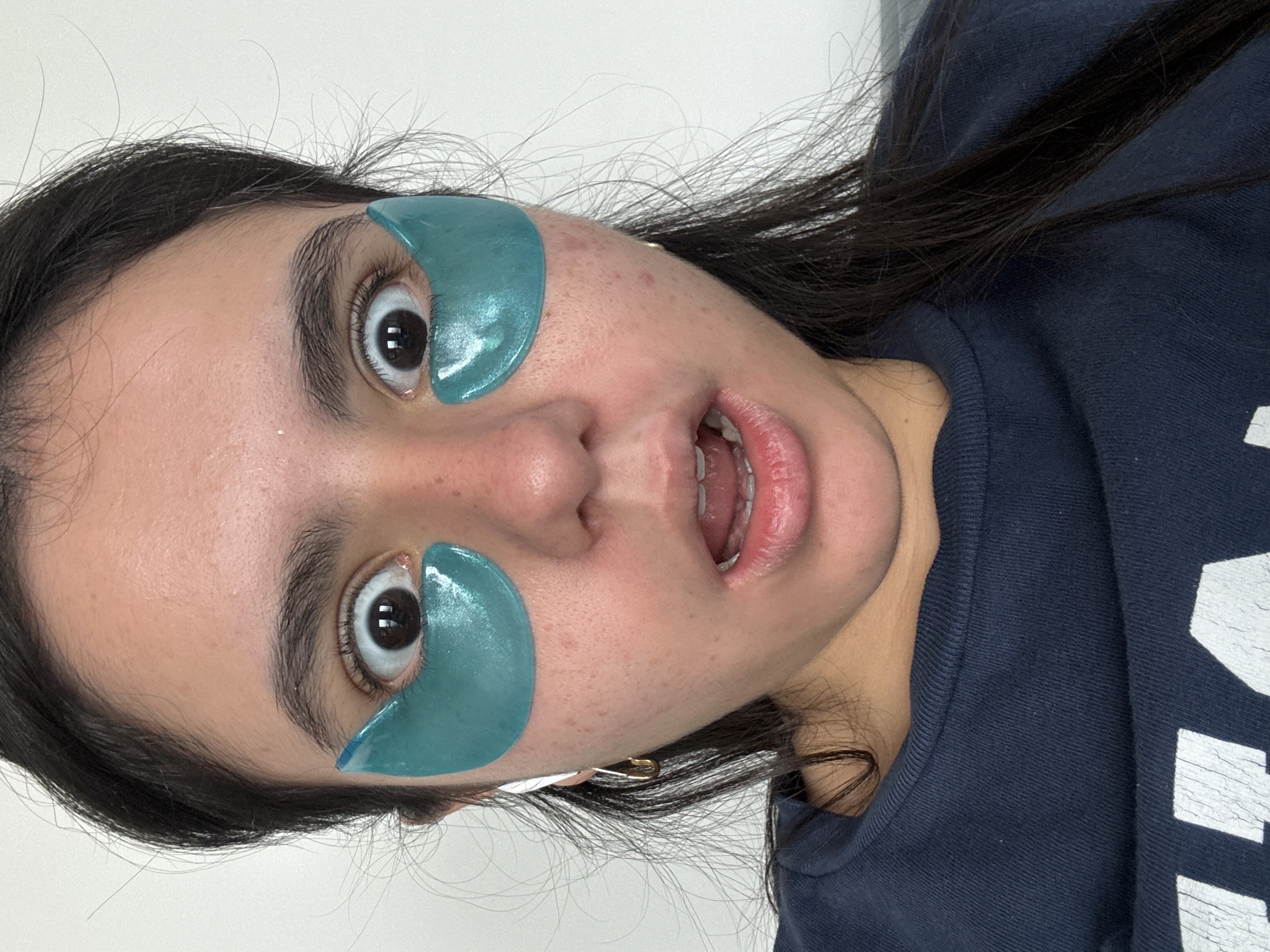 A young woman is shown in a close-up, tilted portrait. She is wearing blue eye patches under each eye and has her mouth open in a surprised expression. She has dark hair and is wearing a dark blue hoodie with white text. The background is a plain white wall. The location cannot be determined from the image.