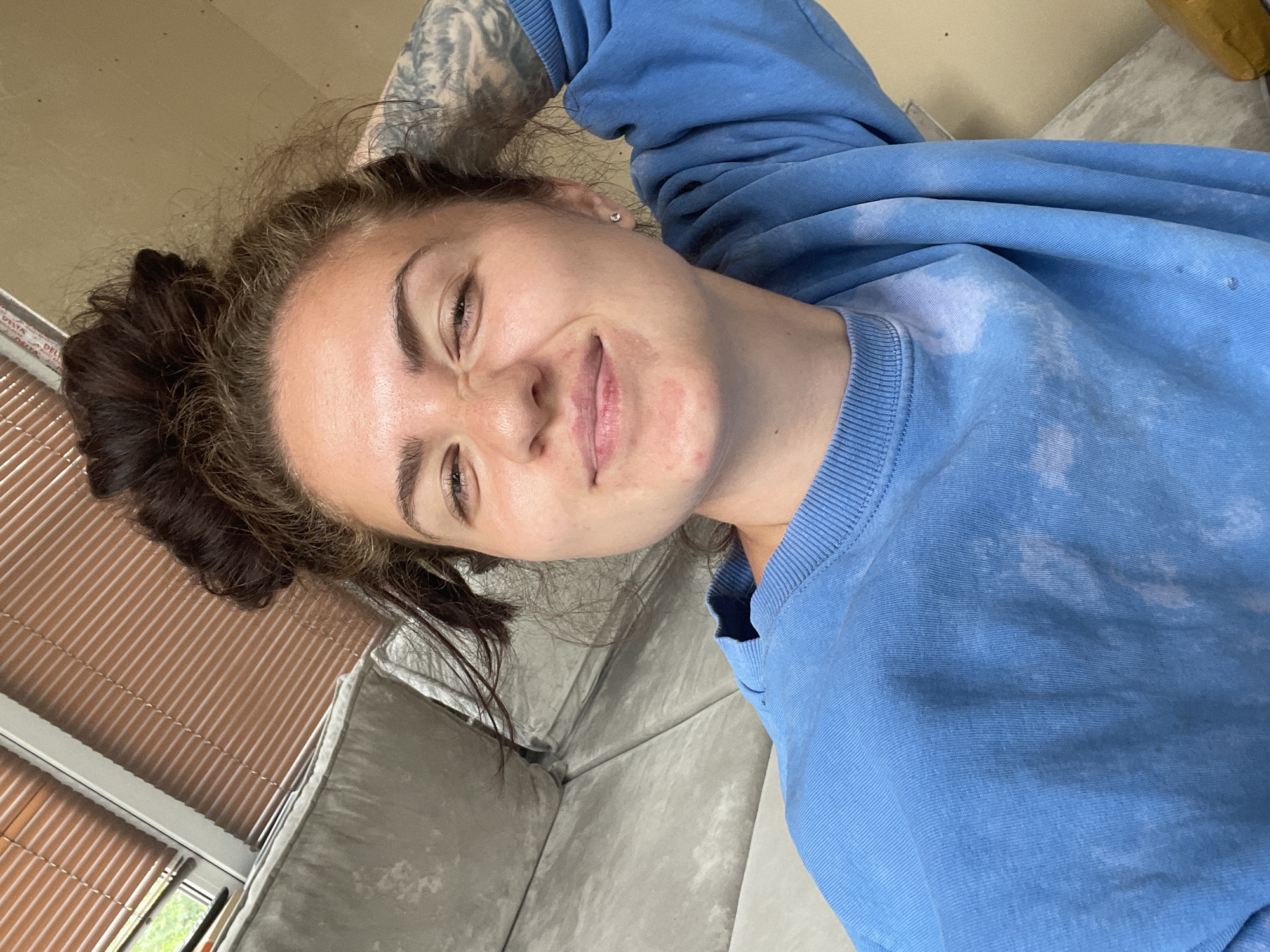A young woman with dark hair pulled up in a messy bun is pictured in a close-up, frontal selfie. She is wearing a light blue crew neck sweatshirt with a tie-dye pattern. She has a light tan complexion with some redness on her cheeks and around her mouth. Her eyes are squinted, and she has a slight smile, with her right hand resting on the back of her head. Tattoos are visible on her right arm. The background shows a portion of a gray sofa, a window with brown blinds, and a wall. The scene appears to be indoors, possibly in a residential setting.
