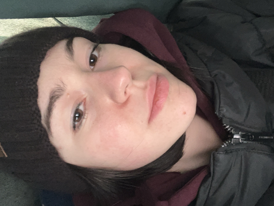 The image depicts a young adult female, likely located in Vita-Poshtova, Ukraine. She is shown in a close-up, headshot-style portrait, looking directly at the camera with a neutral expression. Her skin exhibits a fair complexion with some areas of redness, particularly on her cheeks, and a small blemish is visible on her chin. Her eyes are brown, and her eyebrows are dark. She has short, dark hair visible beneath a dark brown knitted beanie covering her head. She is dressed in a maroon hooded sweatshirt, layered under a black quilted puffer jacket, which is partially zipped up at the front. The background is out of focus and indistinct, showing muted dark and teal-green tones, suggesting an enclosed or interior setting. No other individuals or specific environmental markers are discernible.