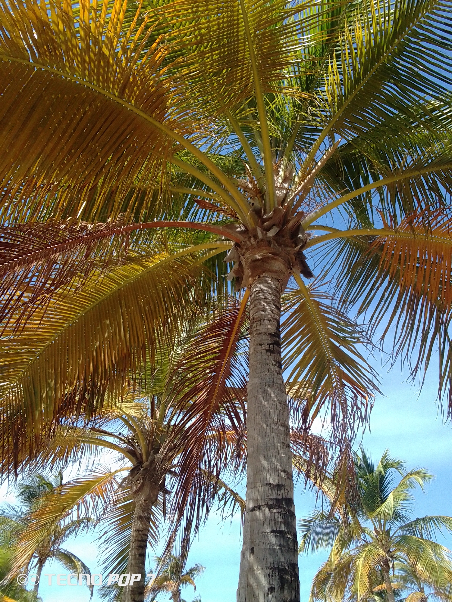 The image captures a collection of palm trees, presumably in Pedro González, Venezuela, given the prompt's instructions. The sky is a clear, light blue with minimal cloud cover. The palm trees vary in size and coloration, some with green fronds and others with yellow or brown, suggesting different stages of growth or health. The trunks are gray with visible textures. The composition is from a low angle, looking up at the trees against the sky.