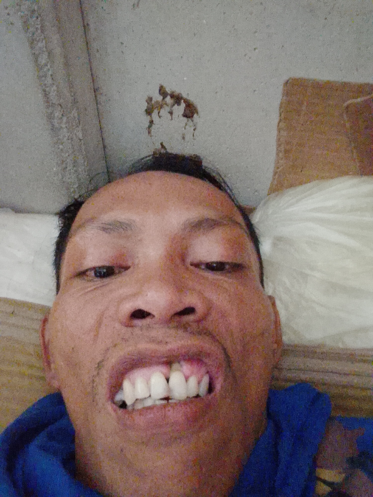 A close-up, selfie-style image shows a middle-aged Asian man lying down. He is wearing a blue shirt or jacket. His teeth are prominently displayed, and he has a noticeable gap in the upper gum line. The background includes a white pillow, a wooden surface, and a concrete ceiling with some debris. The picture was taken in Bukit Ketok, Indonesia.